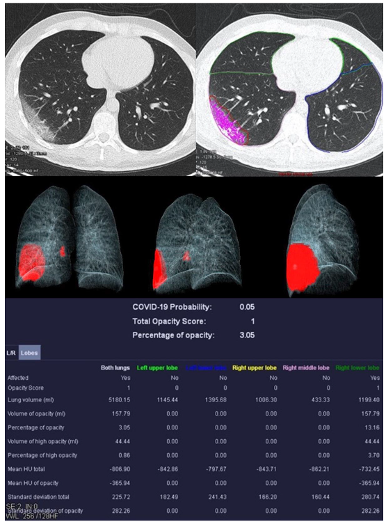 Diagnostics 13 02129 g002 Diagnostics 13 02129 g002