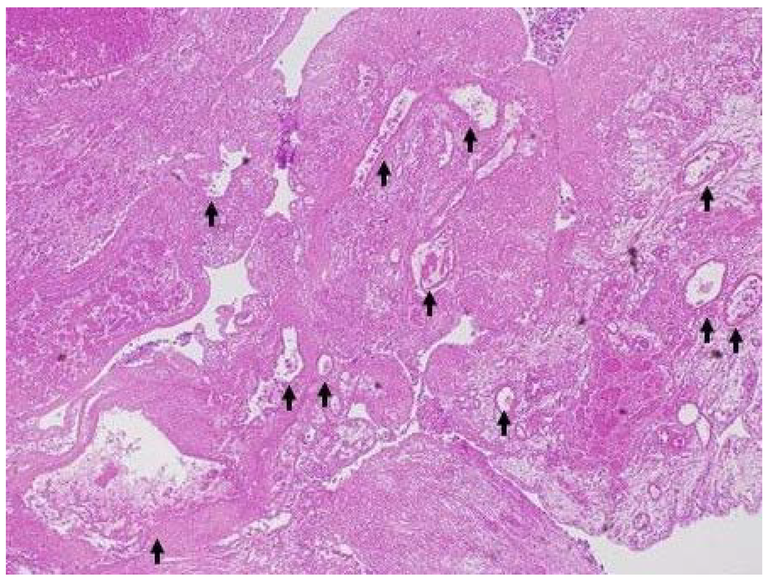 Diagnostics 13 02132 g005