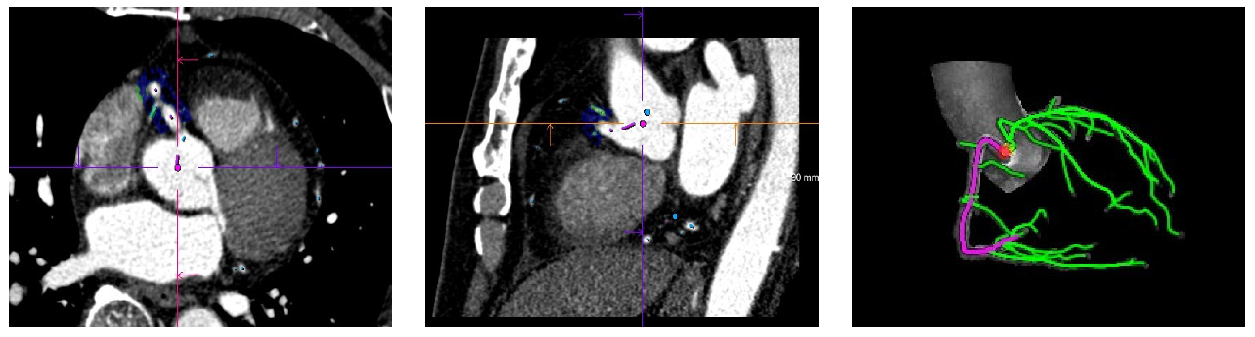 Diagnostics 13 02136 g001 Diagnostics 13 02136 g001