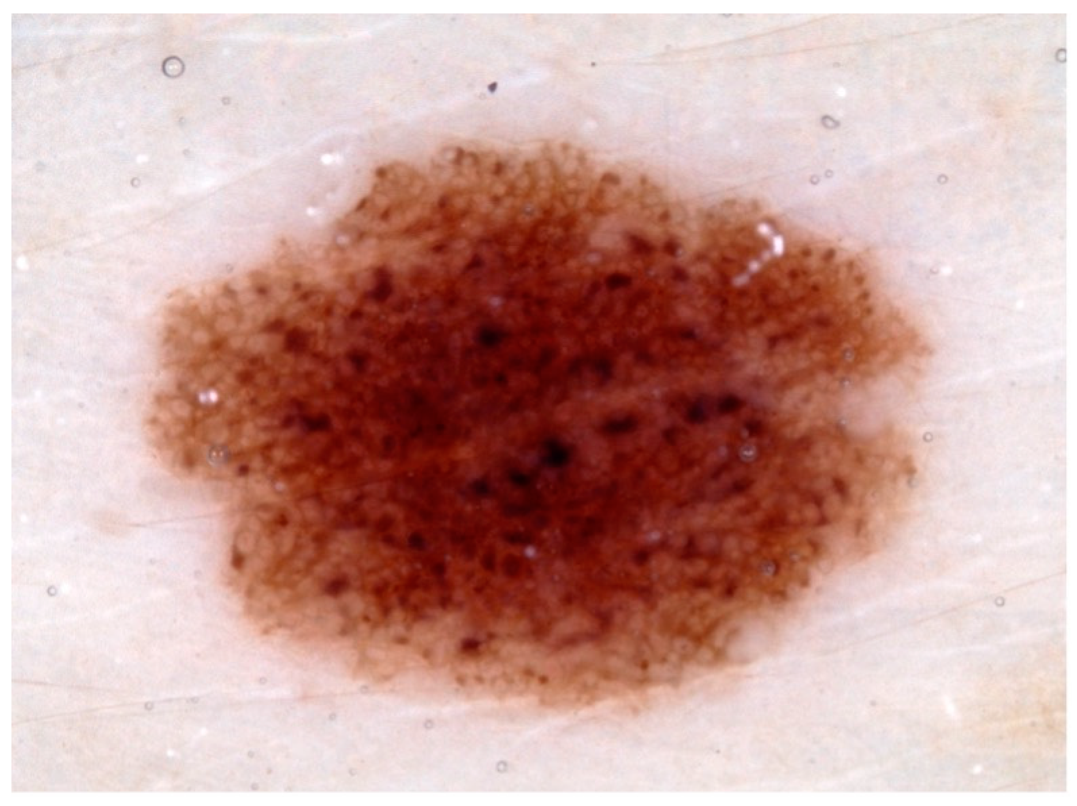 Diagnostics 13 02139 g002 Diagnostics 13 02139 g002