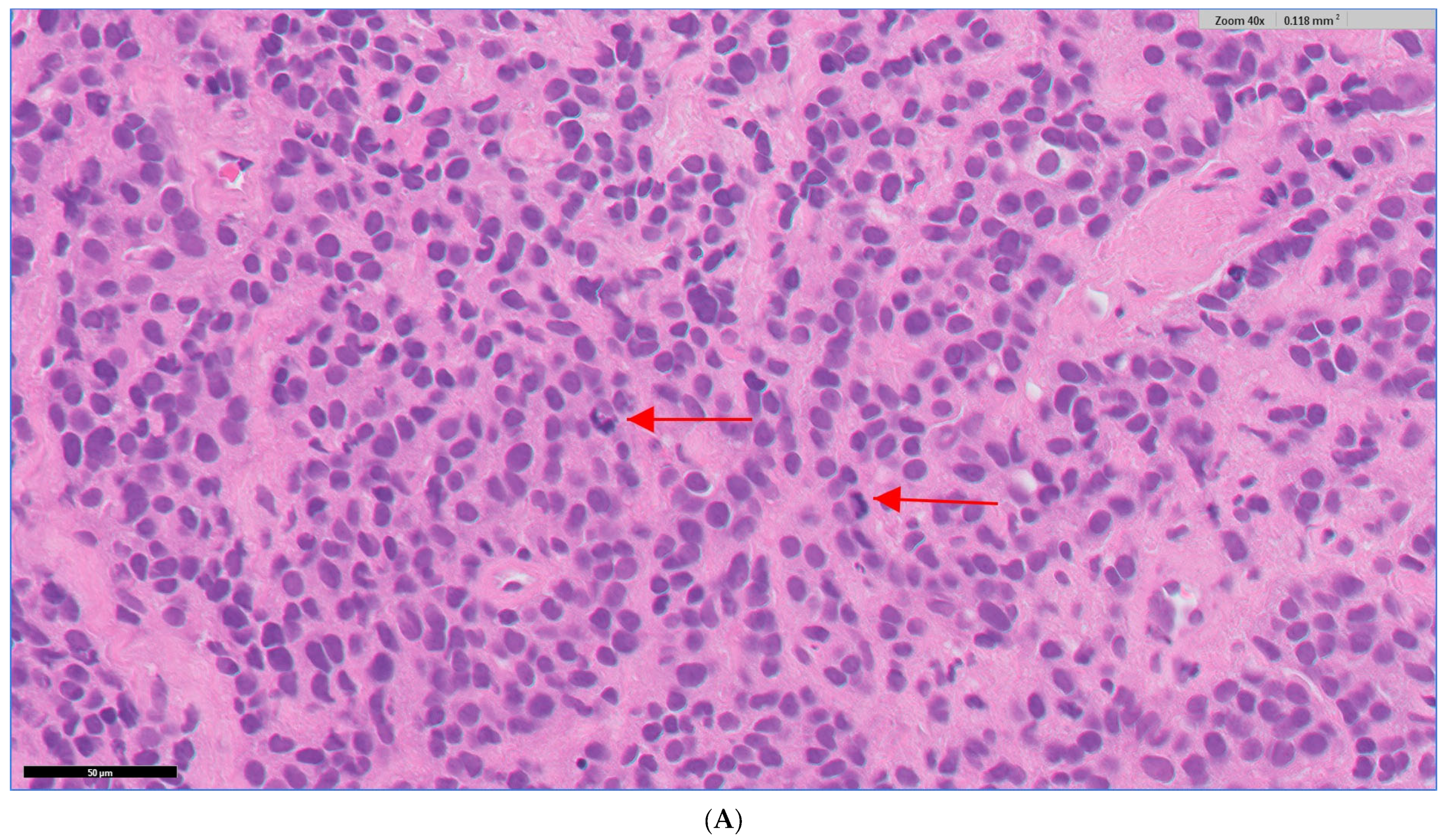 Diagnostics 13 02144 g003a