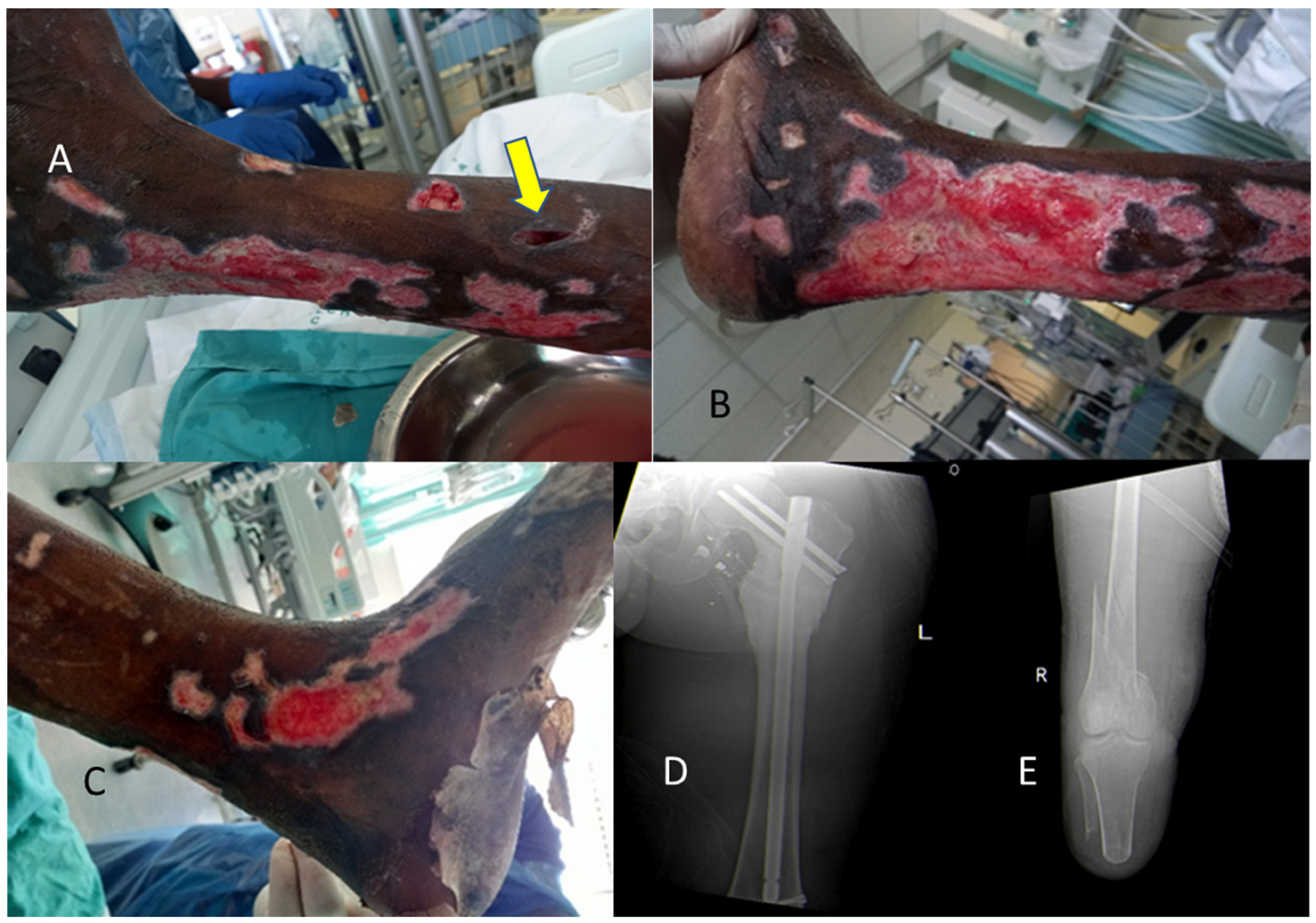 Diagnostics 13 02150 g003