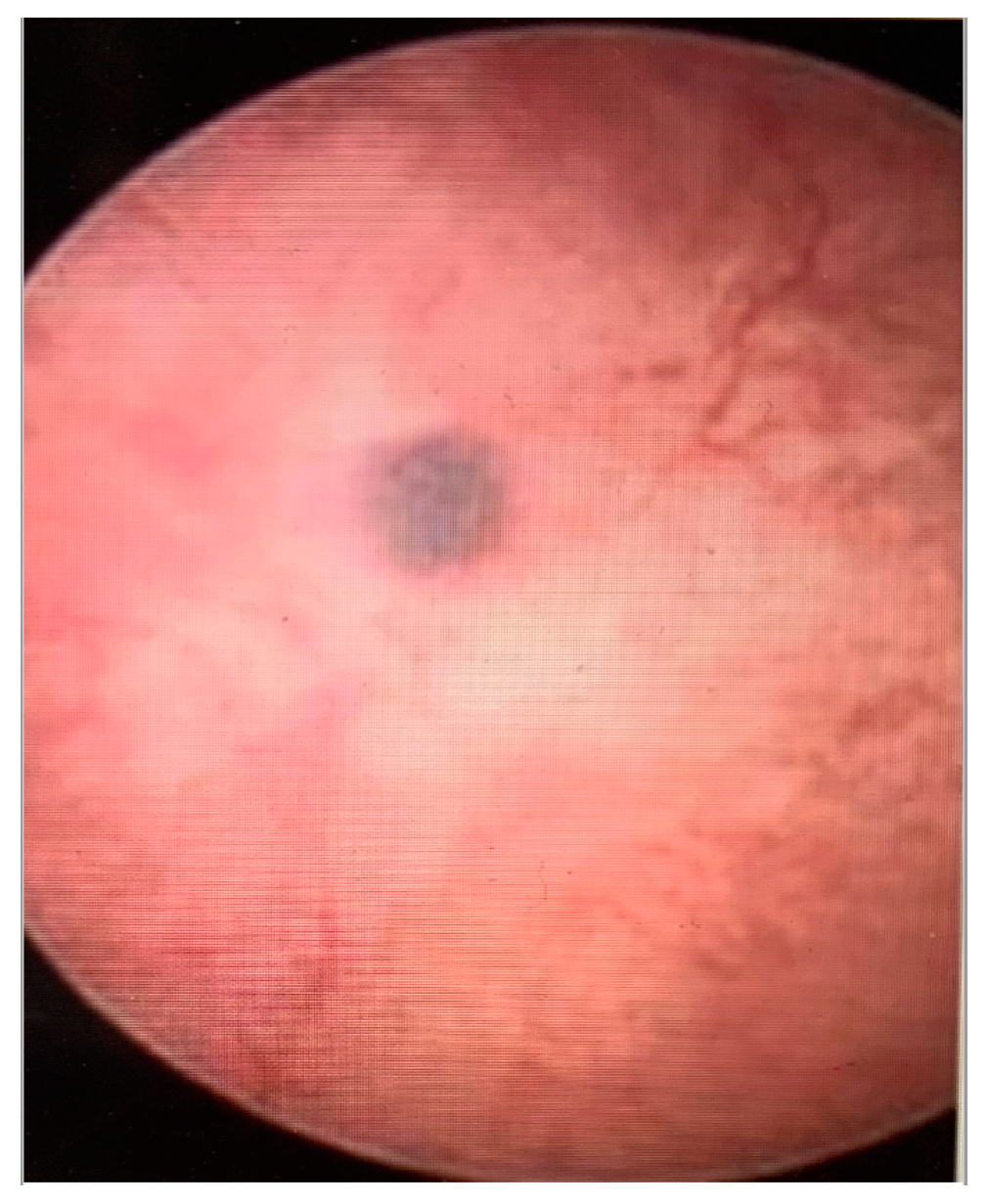 Diagnostics 13 02182 g004