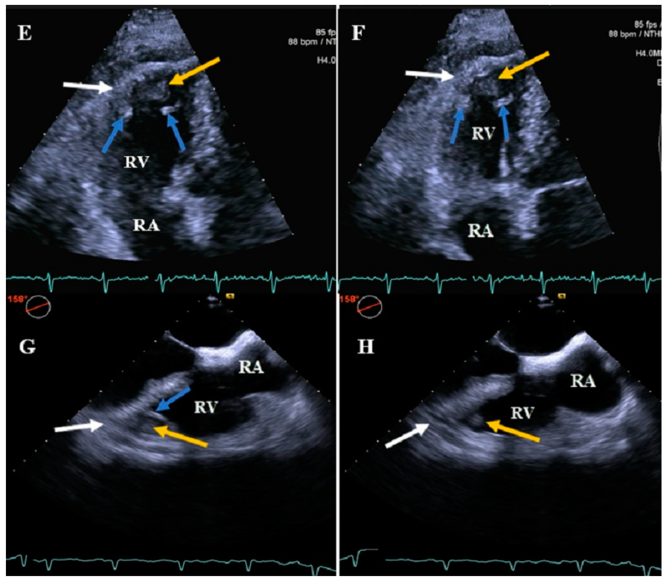 Diagnostics Free FullText TwoDimensional Transthoracic