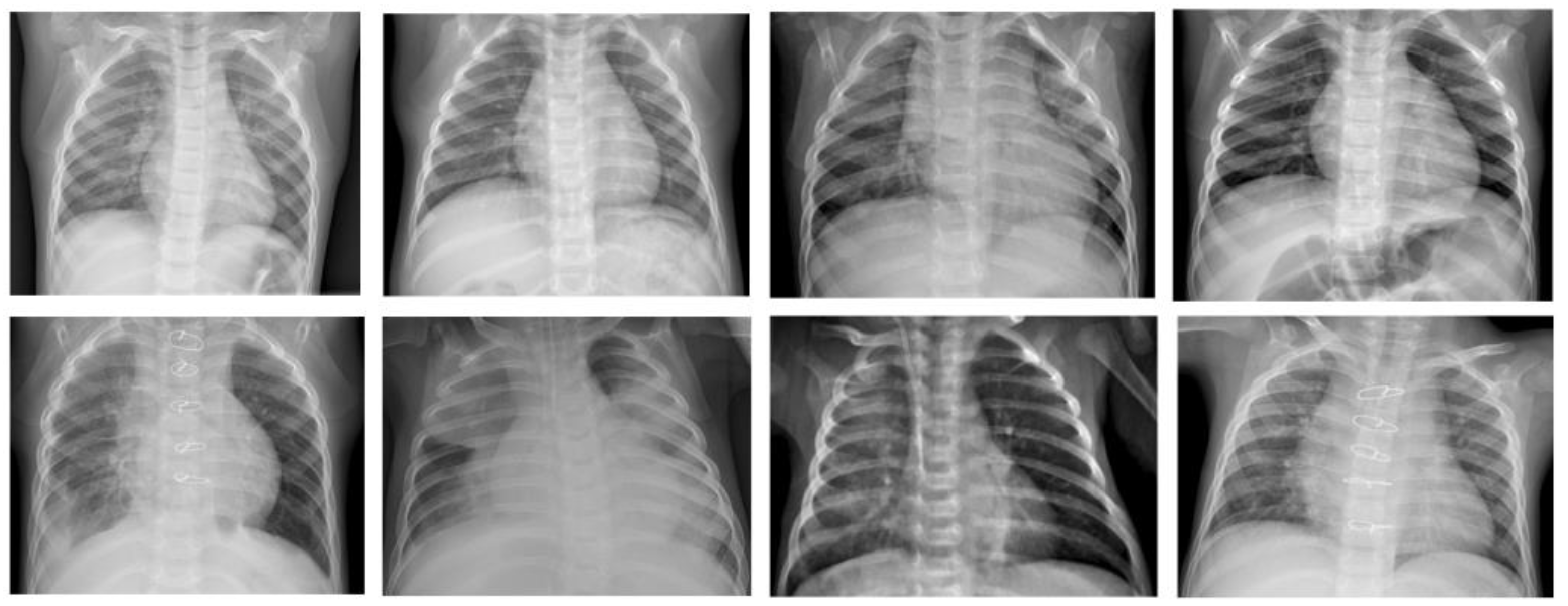 Diagnostics 13 02199 g001