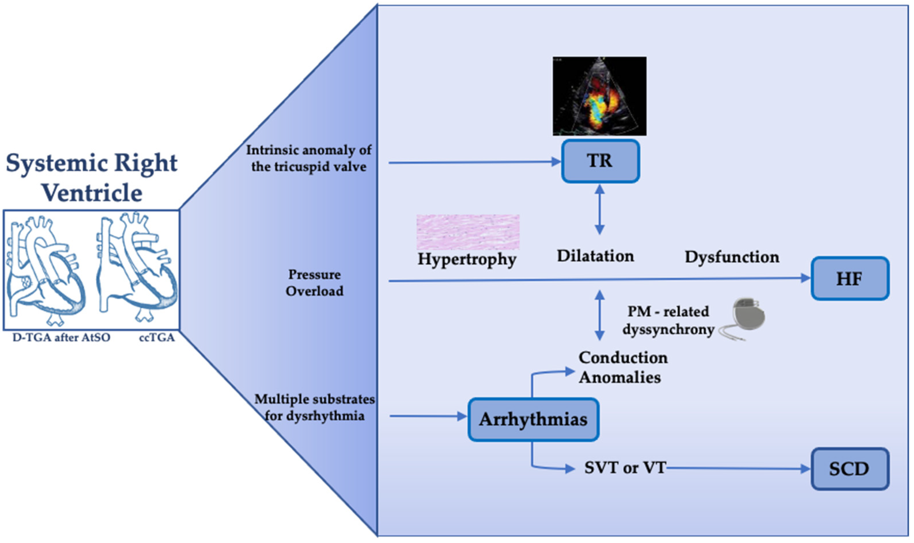 RV Global Longitudinal Strain a Predictor of Mortality in Ebstein