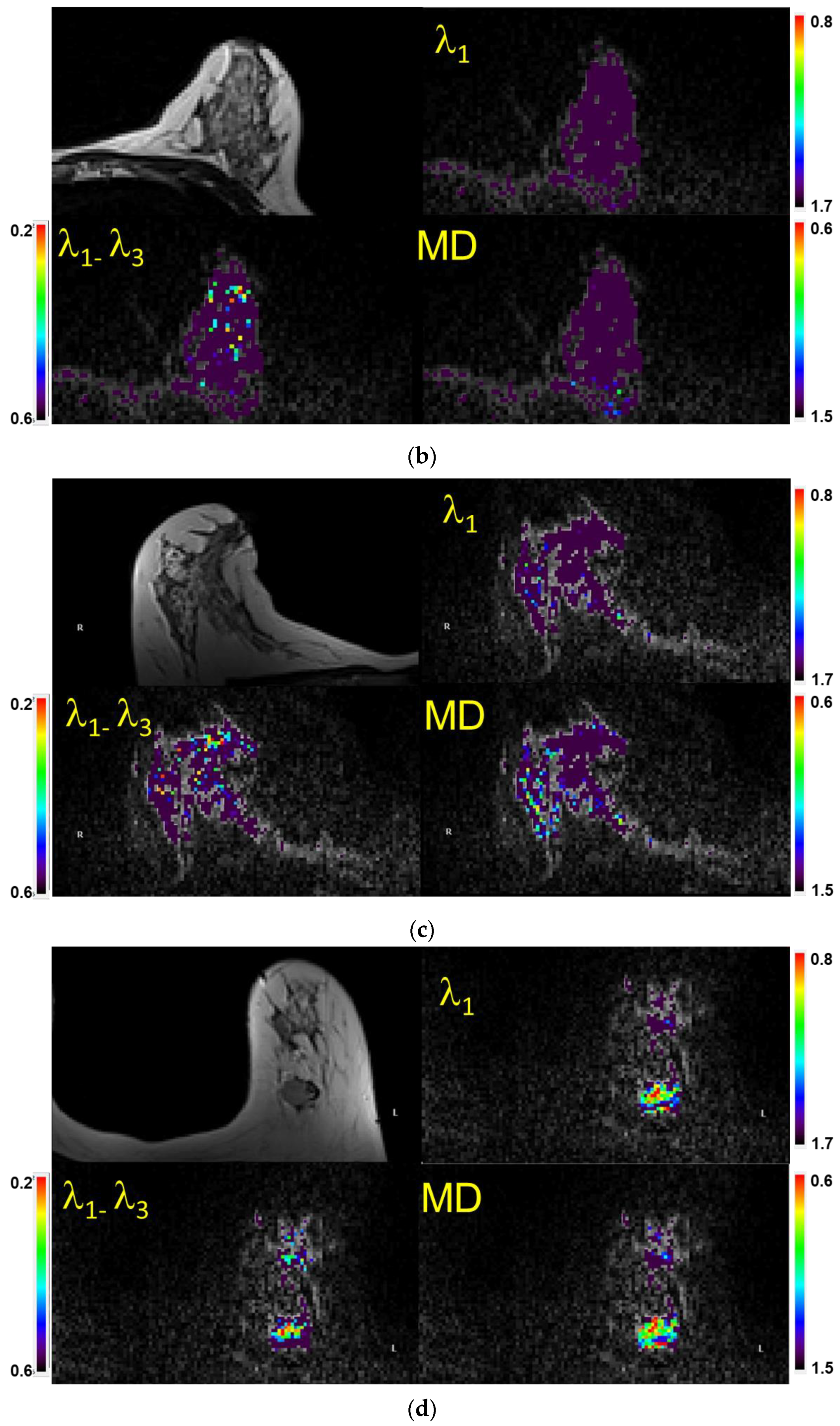 Diagnostics 13 02226 g003b Diagnostics 13 02226 g003b