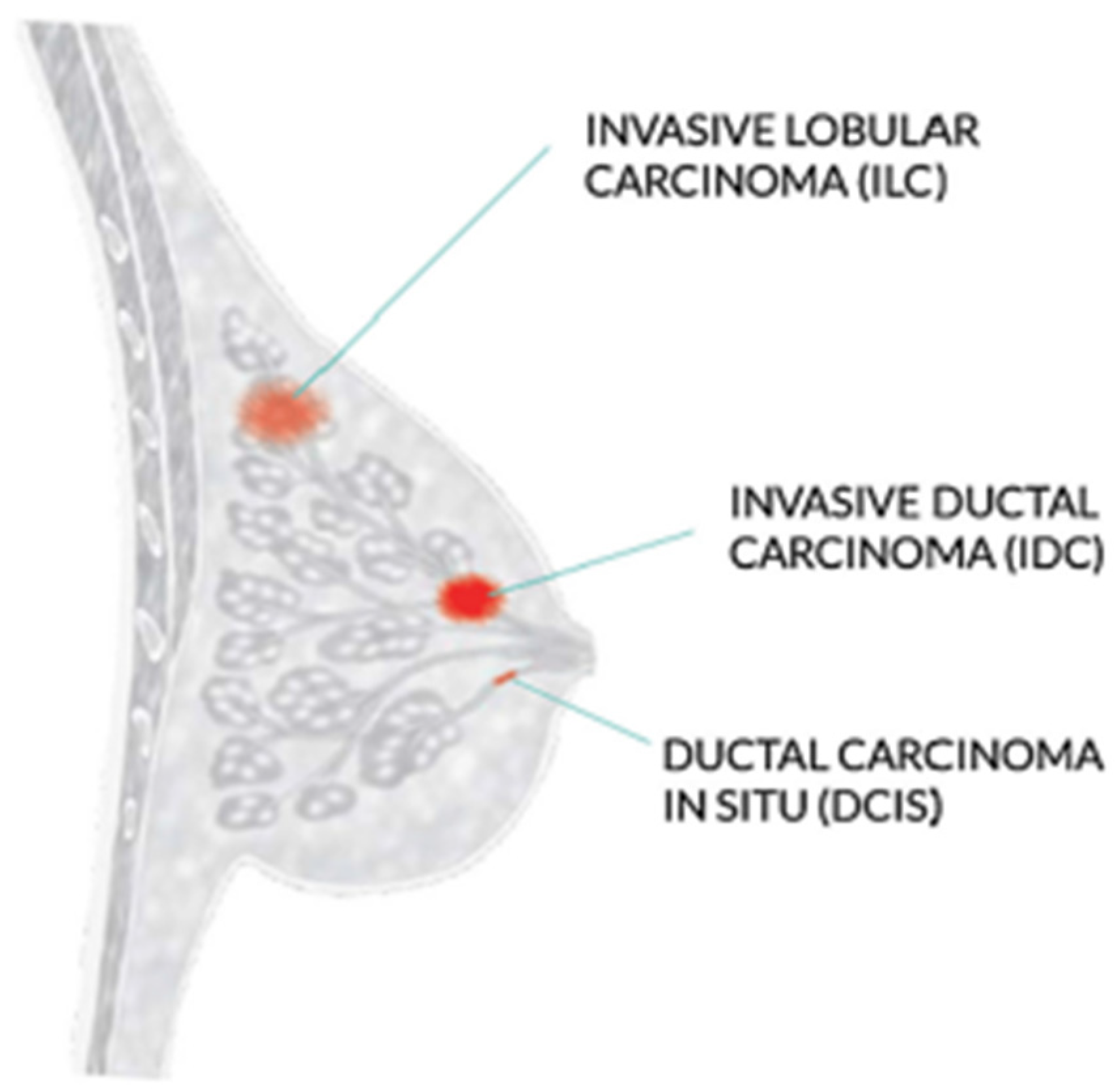 Diagnostics free full text breast cancer classification through