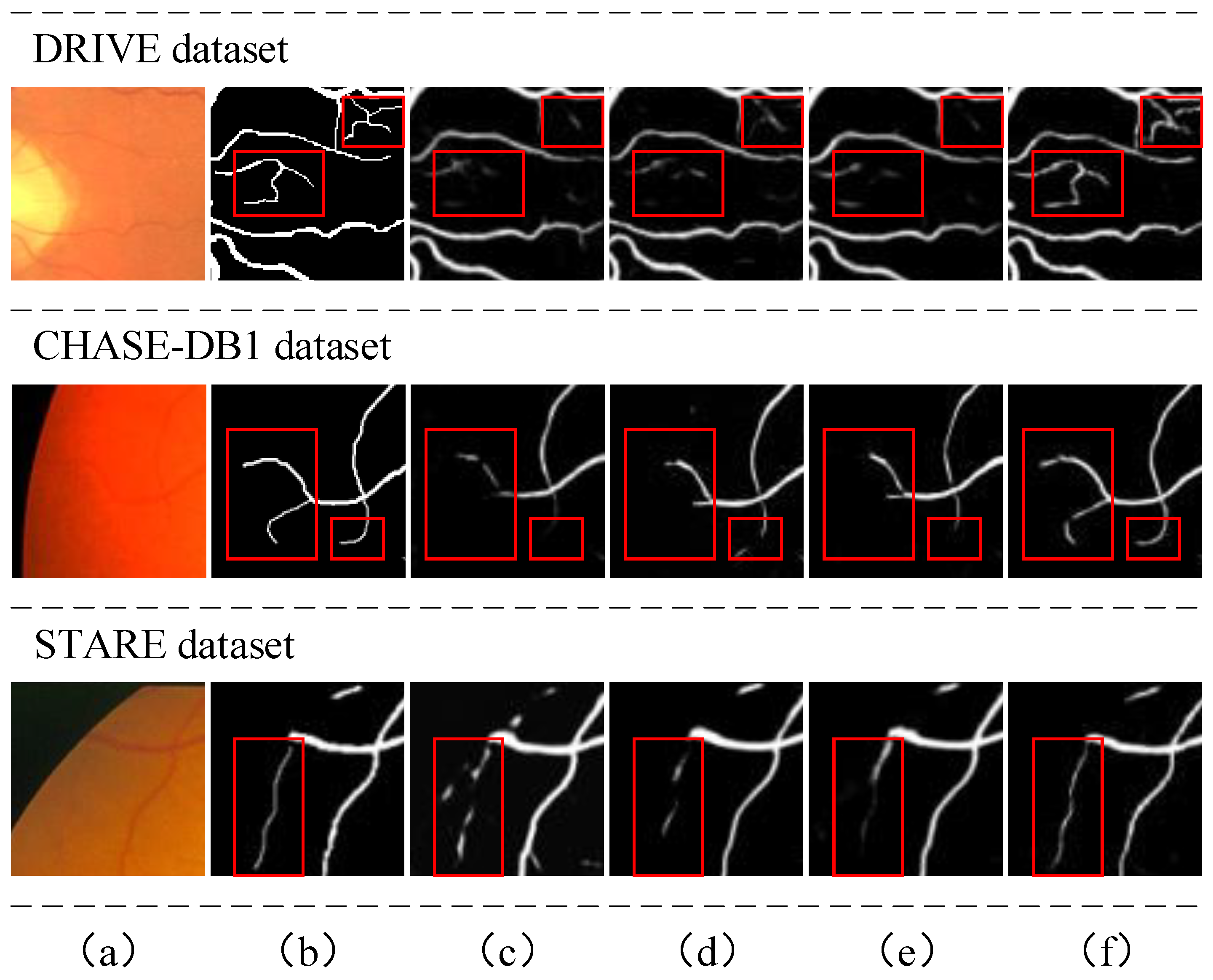 Diagnostics 13 02260 g003 Diagnostics 13 02260 g003