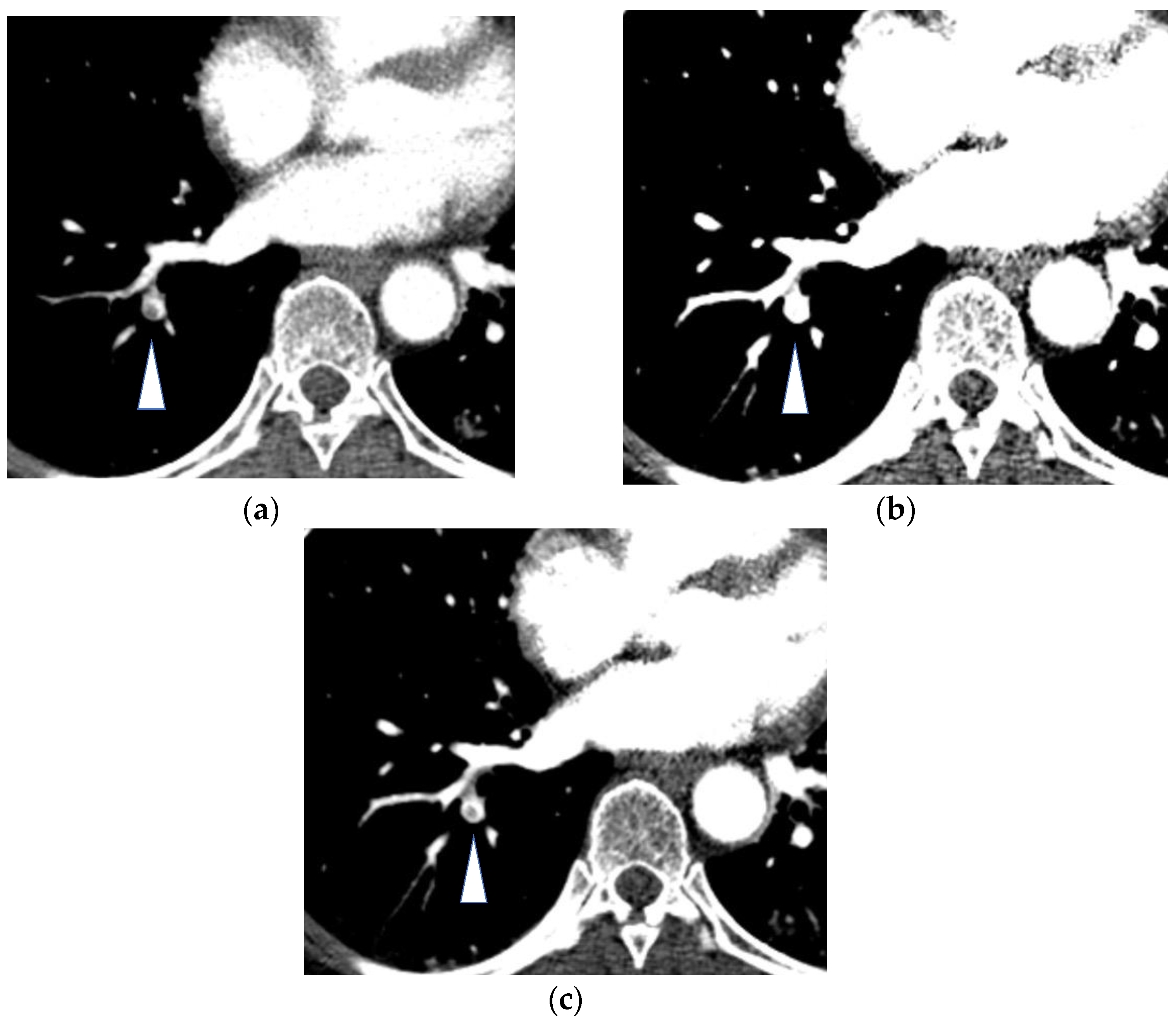 Diagnostics 13 02295 g003