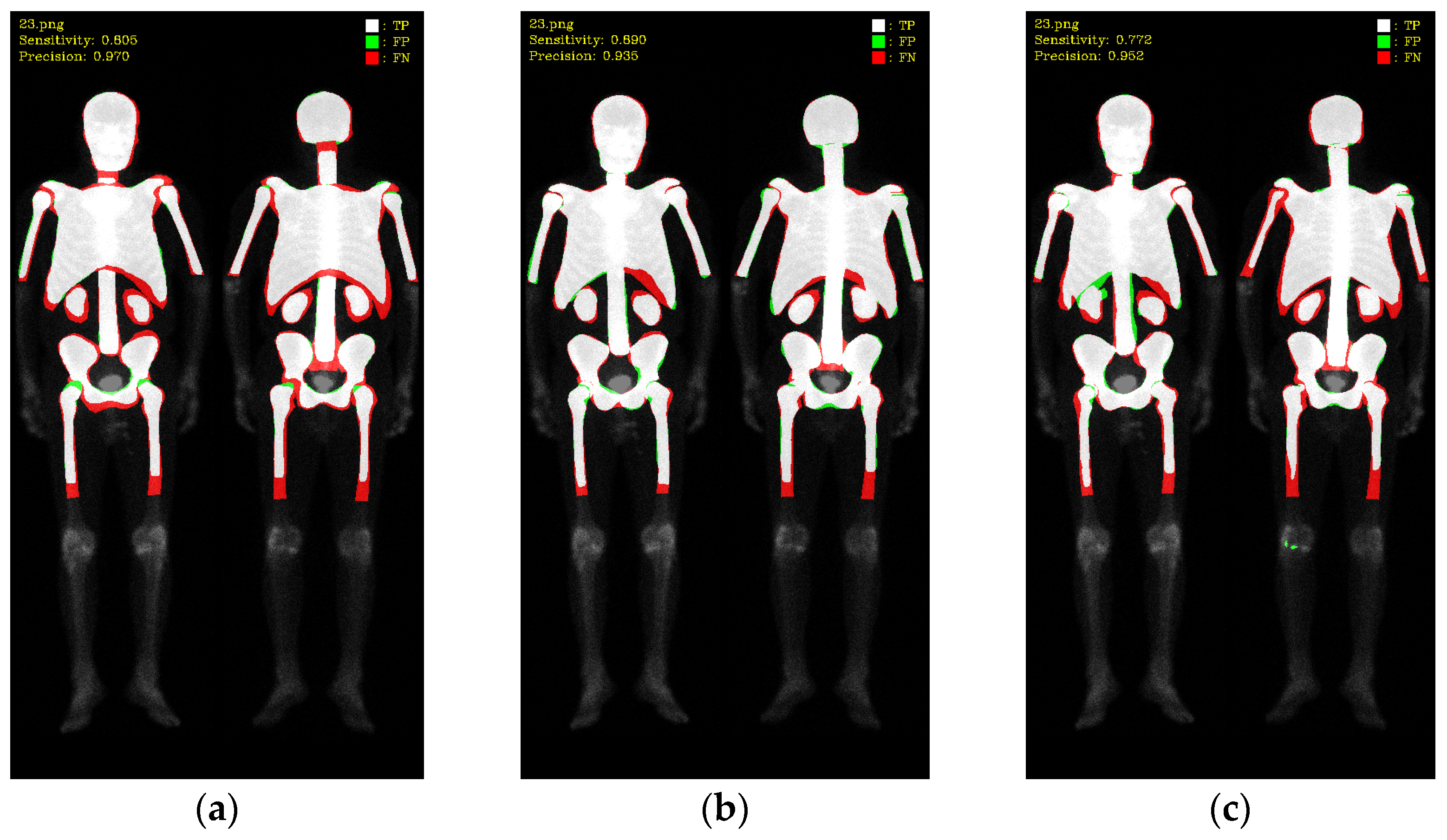 Diagnostics 13 02302 g009