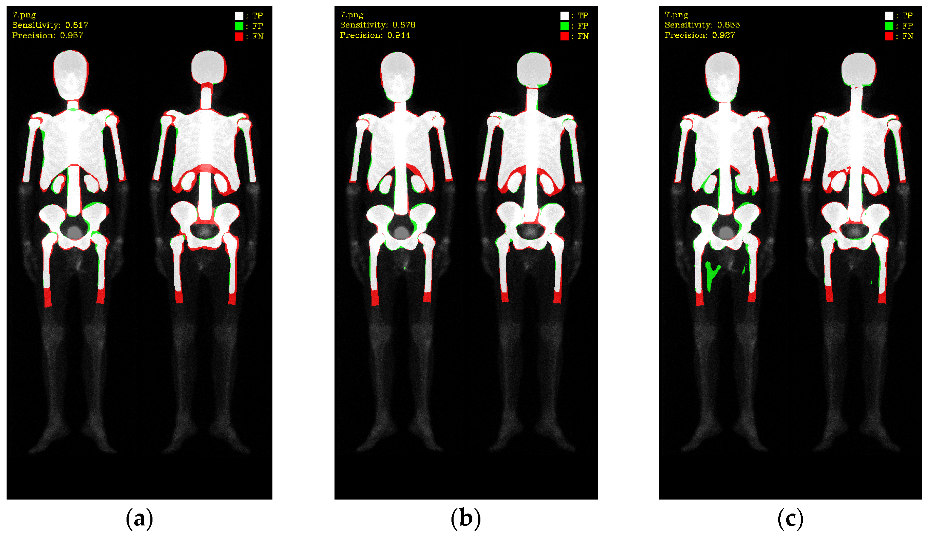 Diagnostics 13 02302 g010