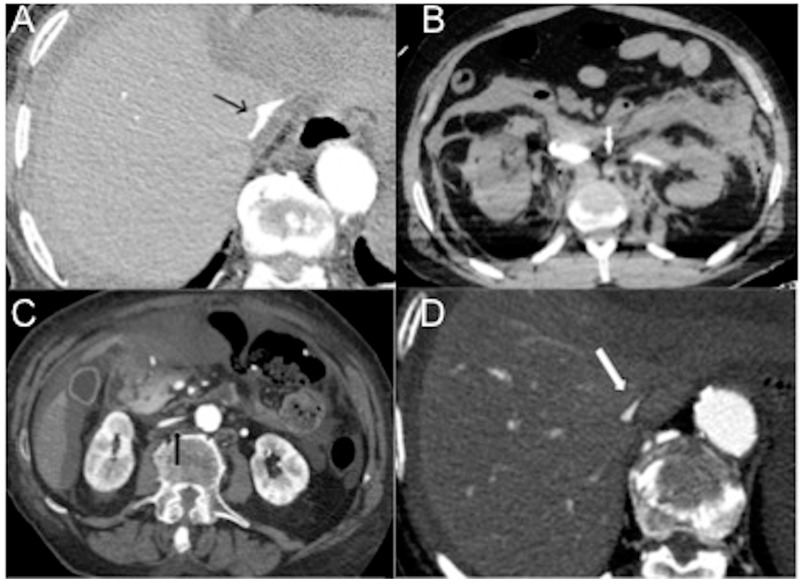 Diagnostics 13 02304 g002 Diagnostics 13 02304 g002