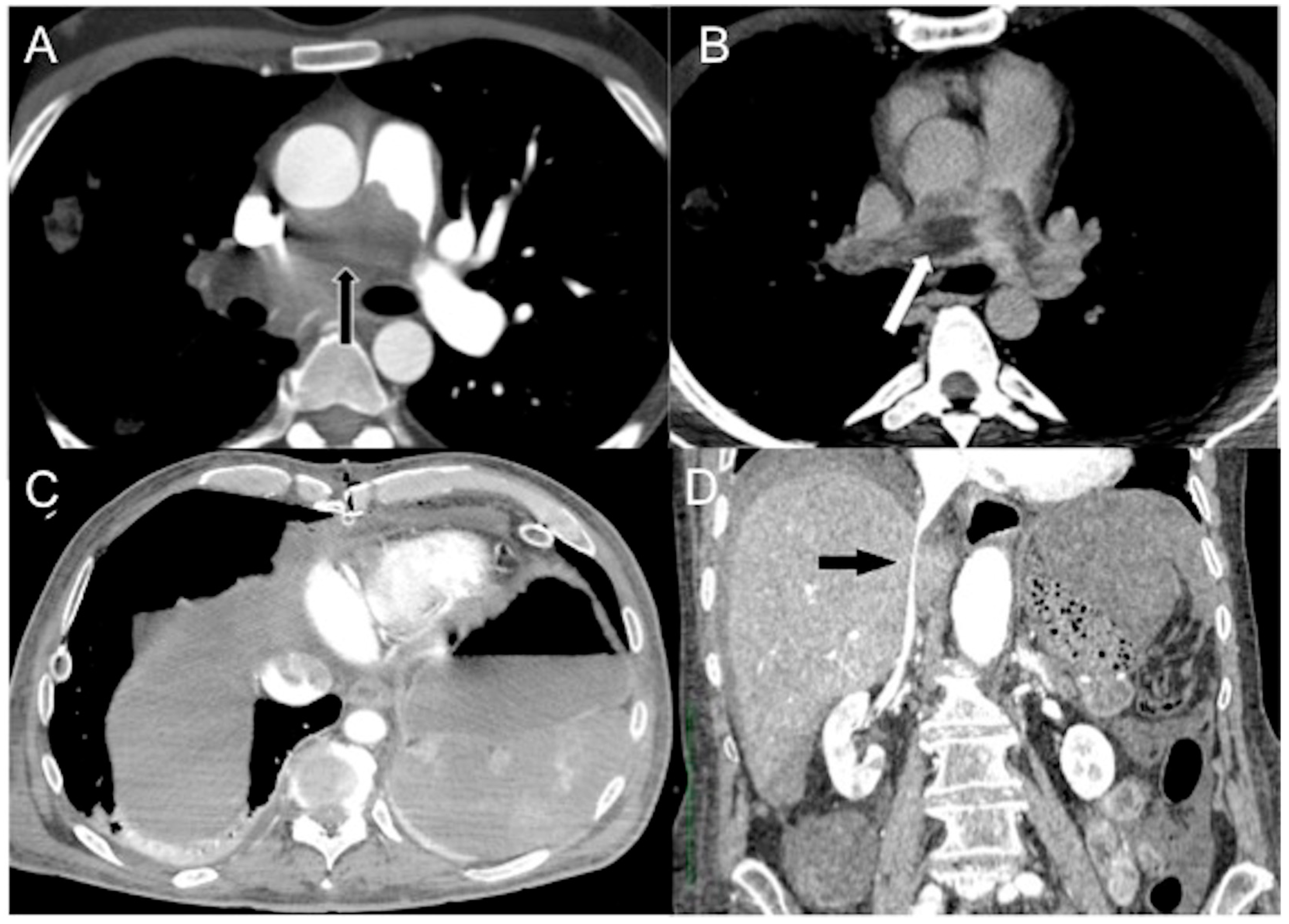 Diagnostics 13 02304 g004 Diagnostics 13 02304 g004