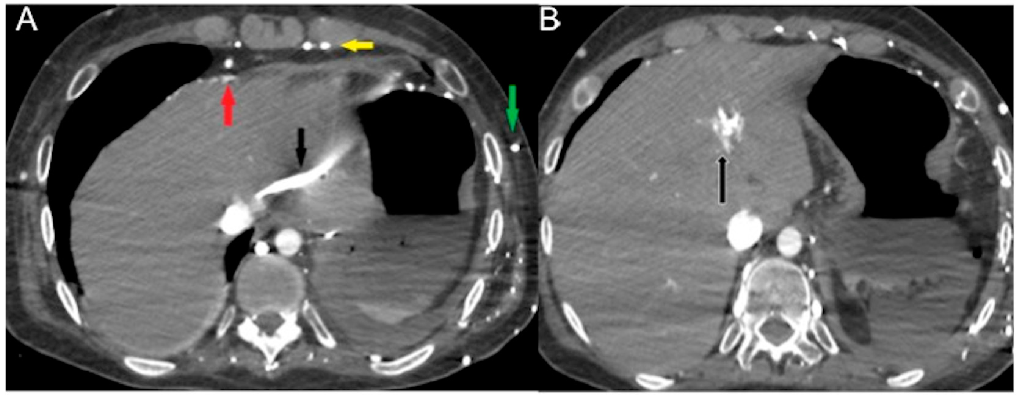 Diagnostics 13 02304 g005 Diagnostics 13 02304 g005