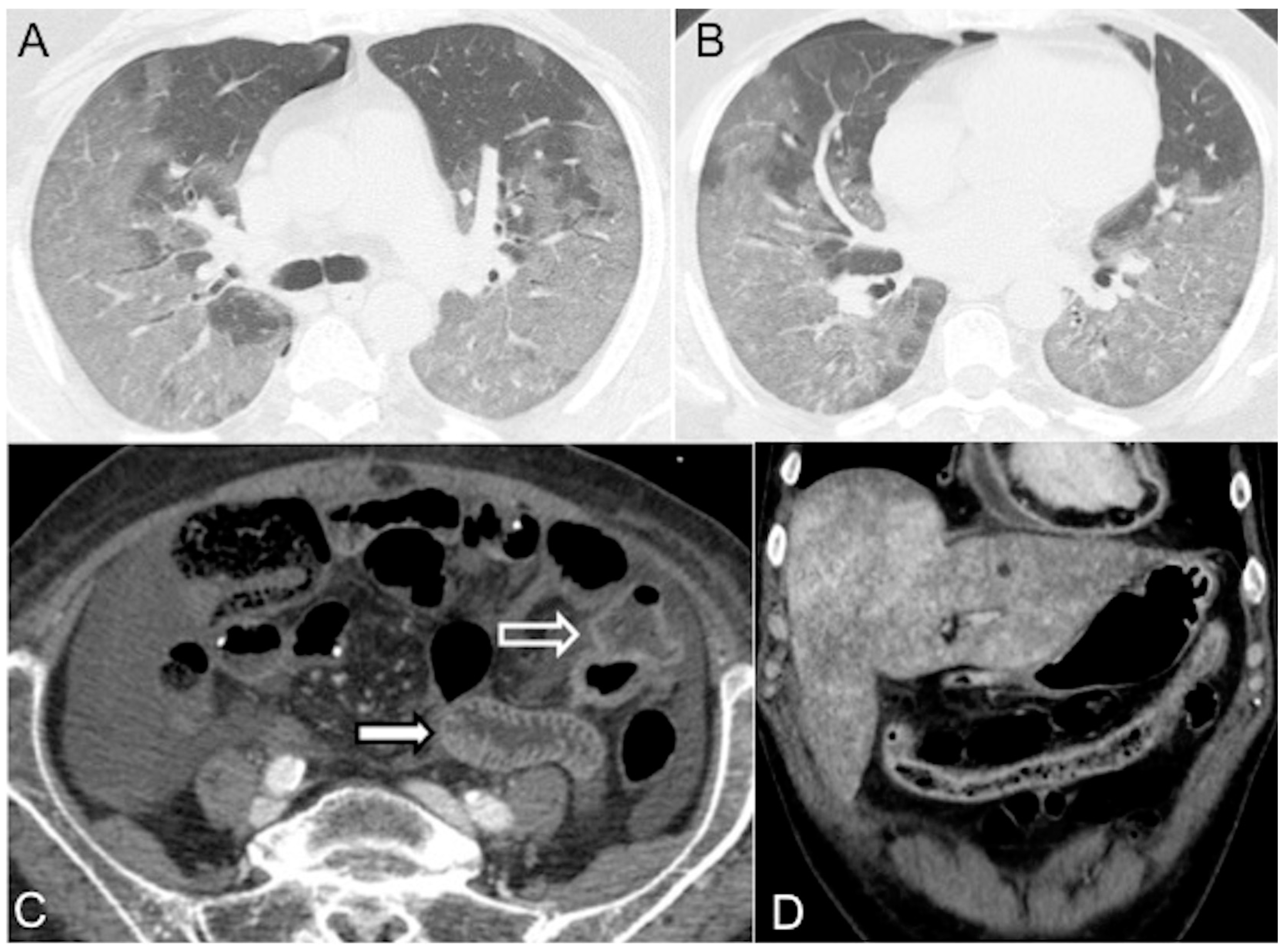 Diagnostics 13 02304 g006 Diagnostics 13 02304 g006