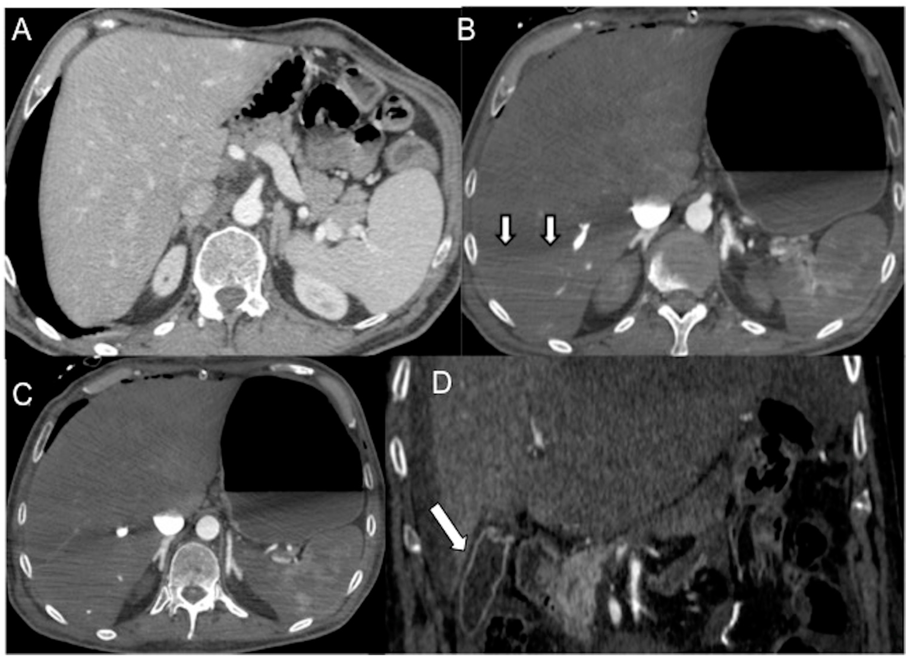 Diagnostics 13 02304 g007 Diagnostics 13 02304 g007
