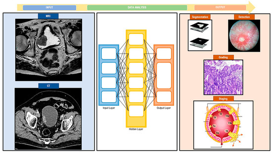 Artificial Intelligence in the Advanced Diagnosis of Bladder Cancer ...