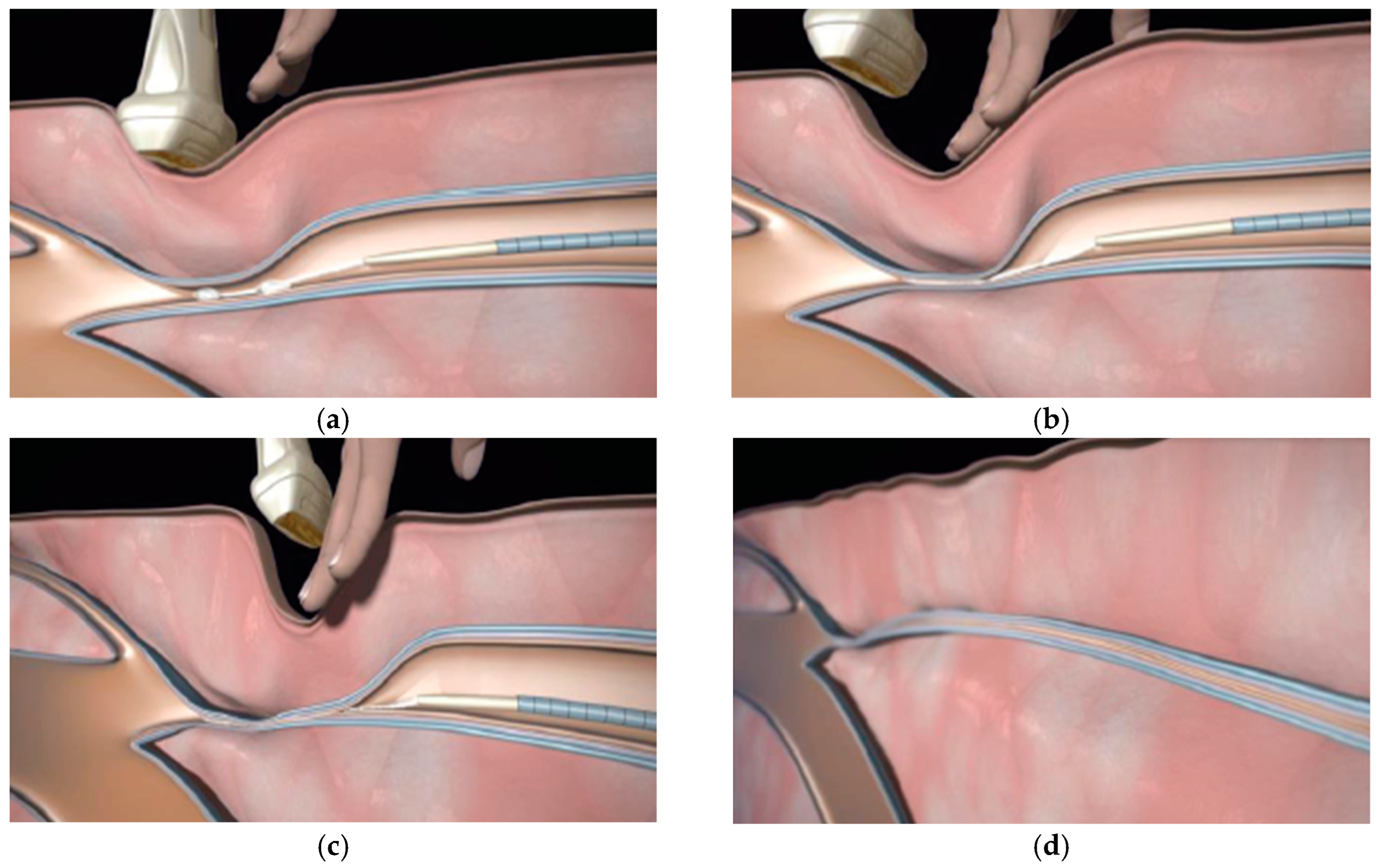 Diagnostics 13 02313 g002