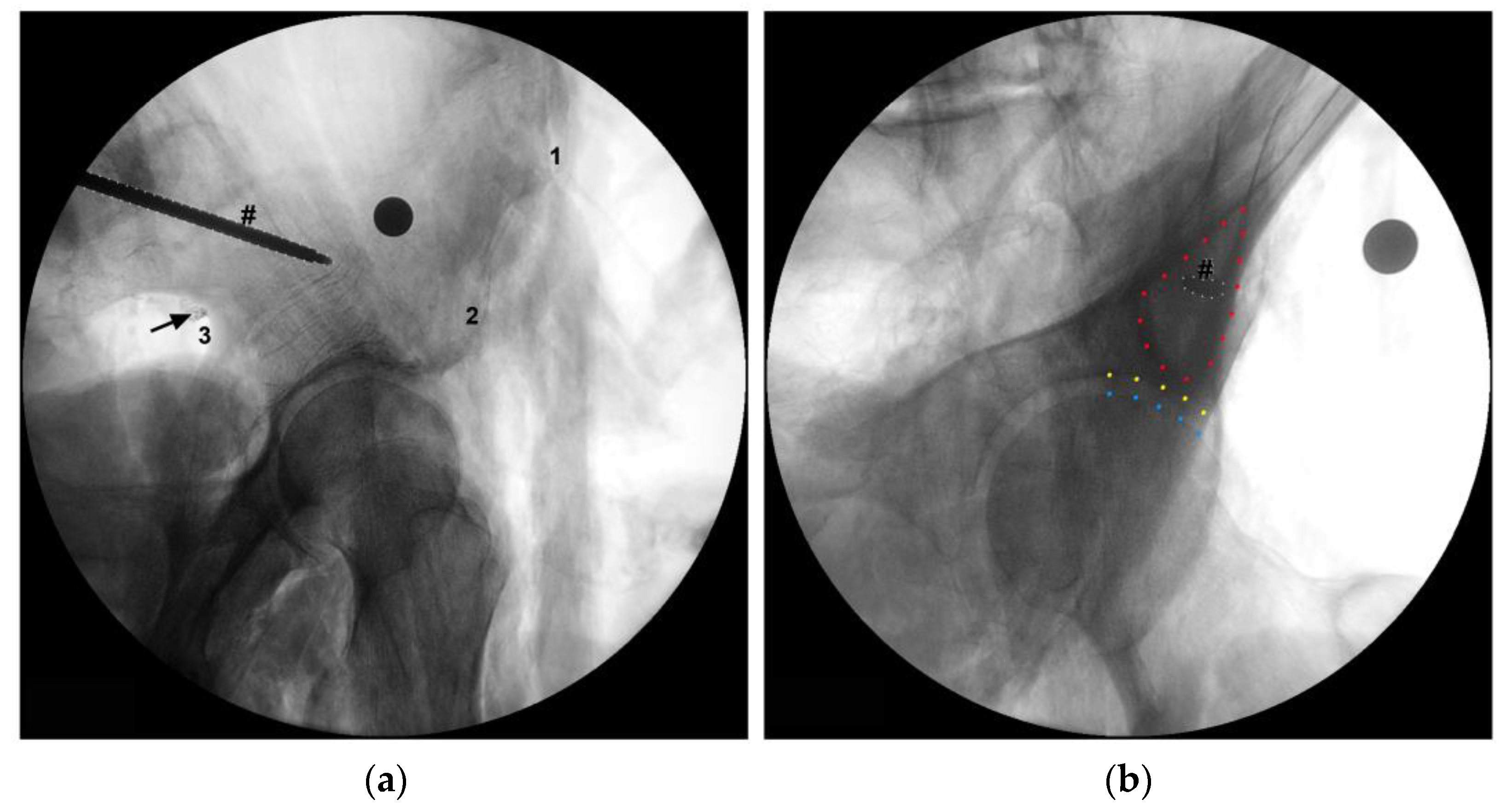 Diagnostics 13 02314 g004
