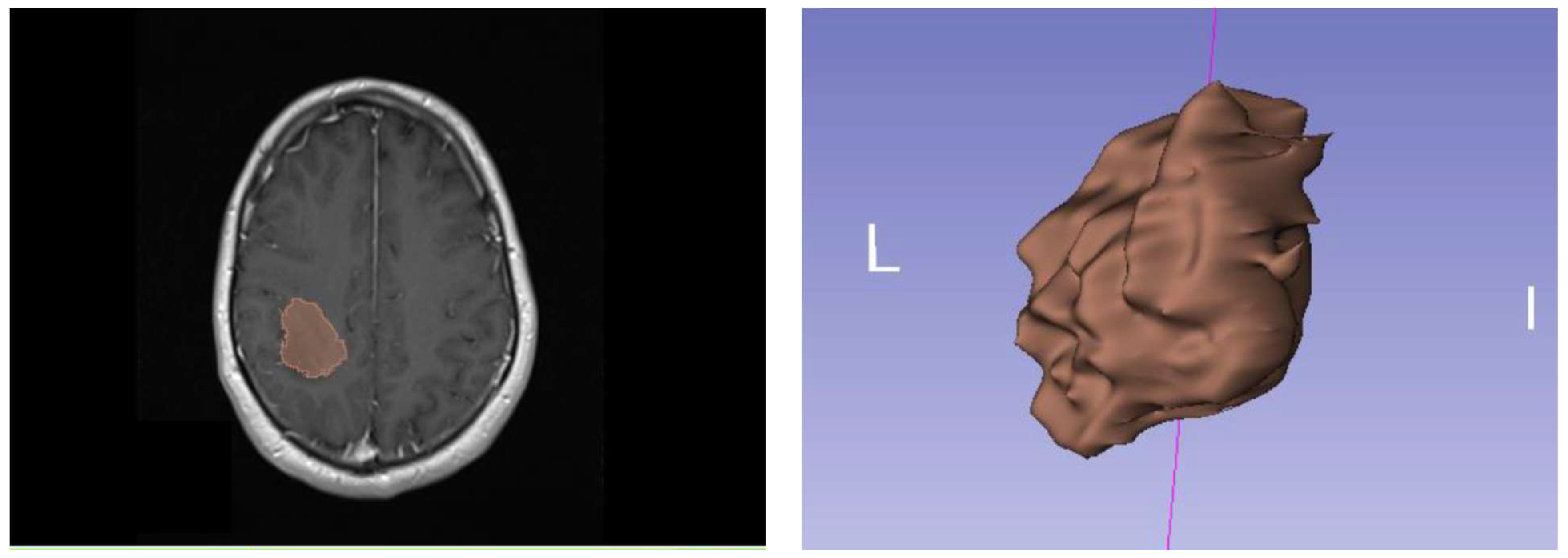 Diagnostics 13 02315 g001