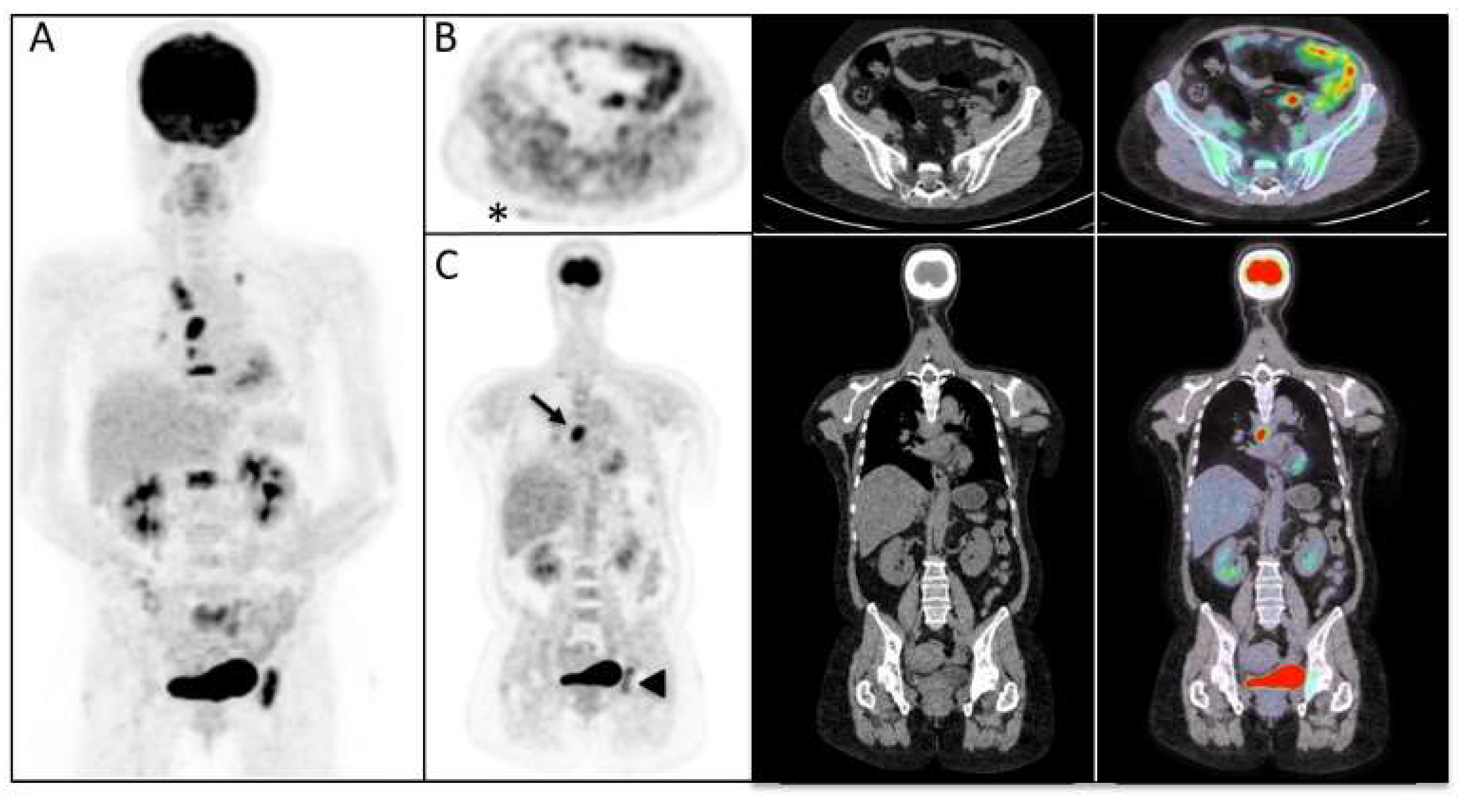 Diagnostics 13 02316 g003 Diagnostics 13 02316 g003