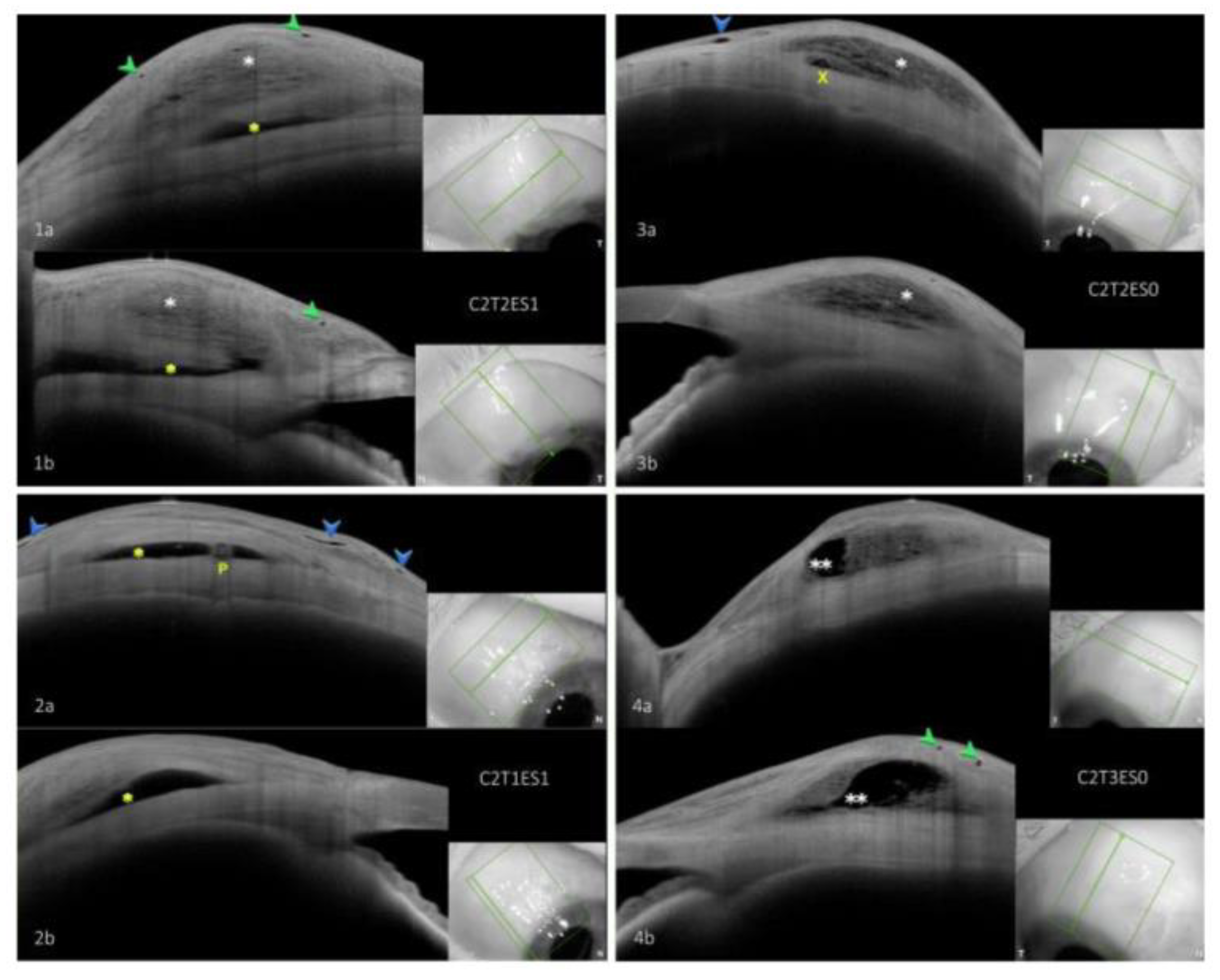 Diagnostics 13 02318 g002 Diagnostics 13 02318 g002