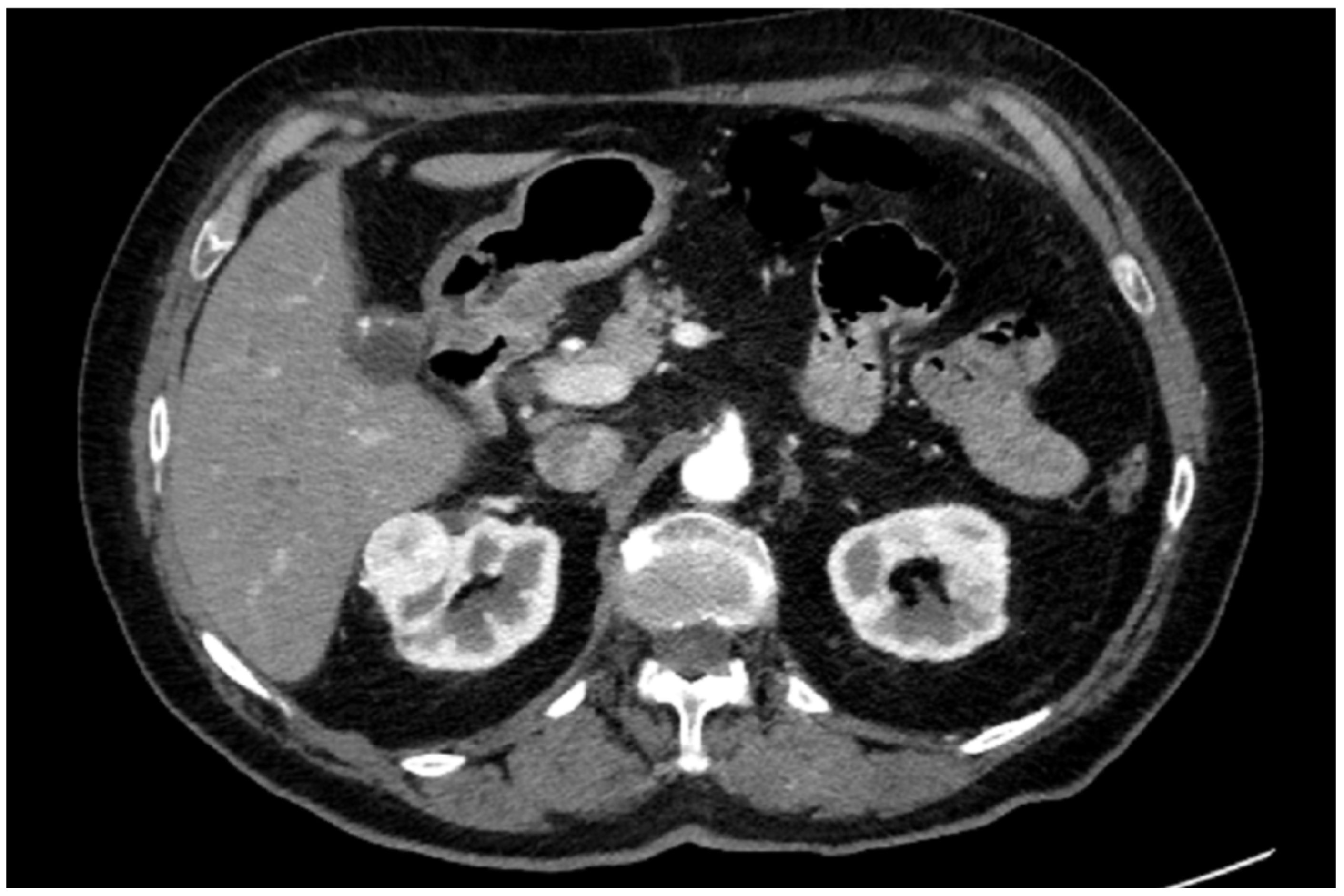 Diagnostics 13 02320 g001