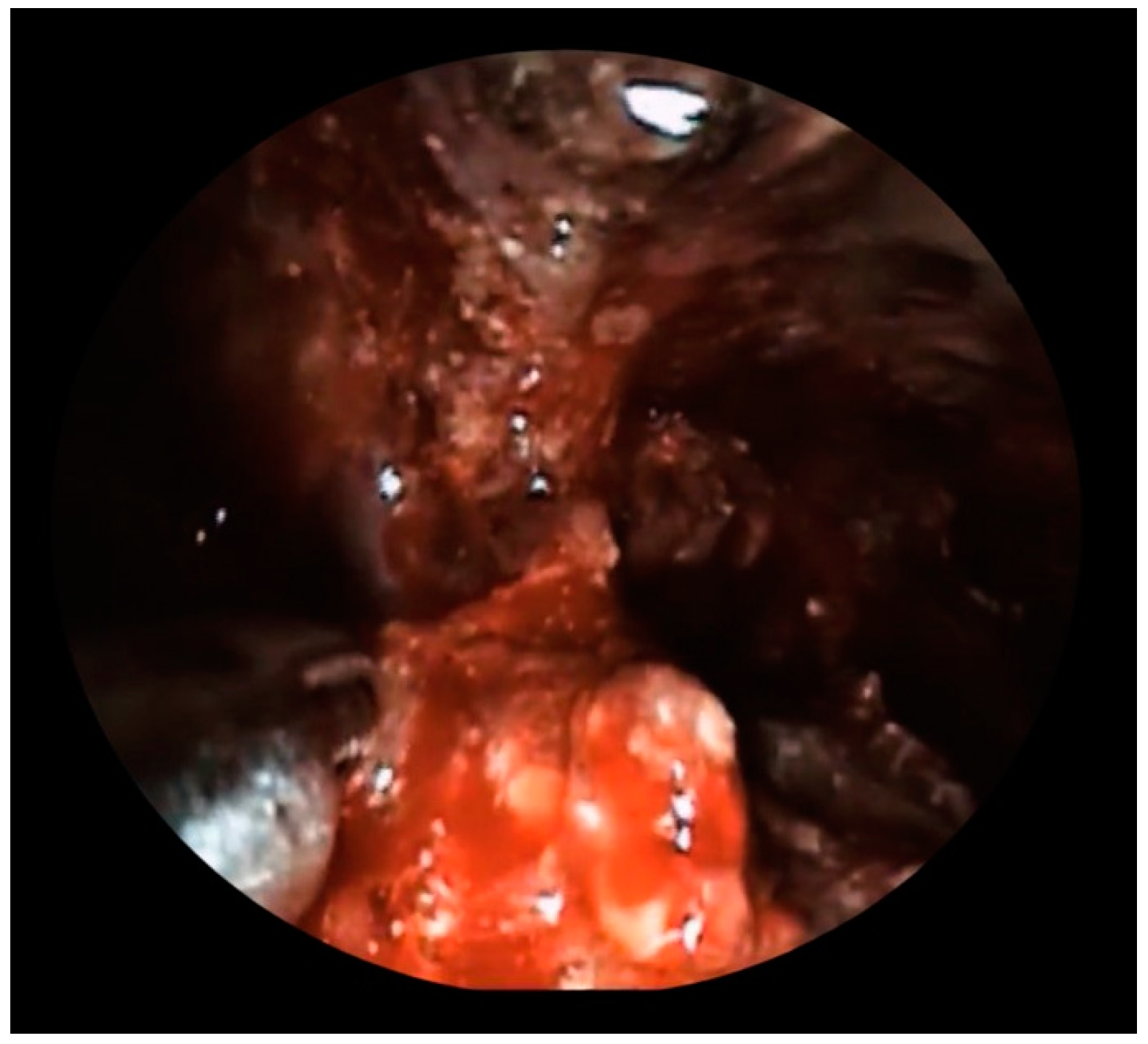 Diagnostics 13 02321 g003