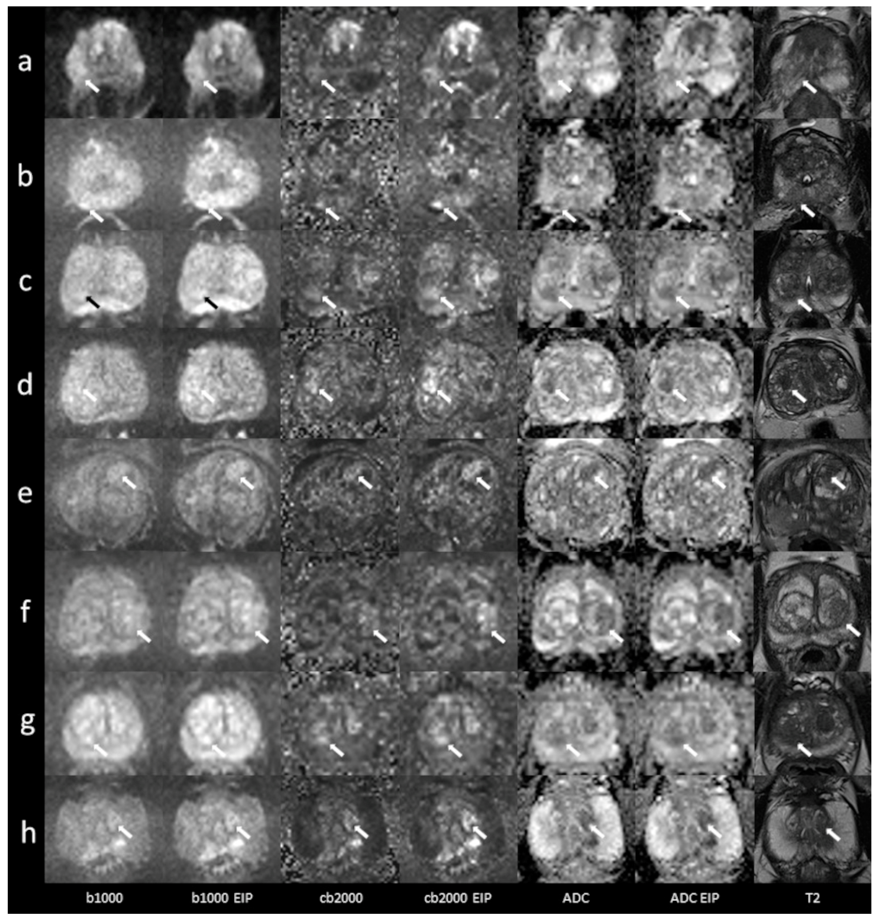 Diagnostics 13 02325 g005 Diagnostics 13 02325 g005