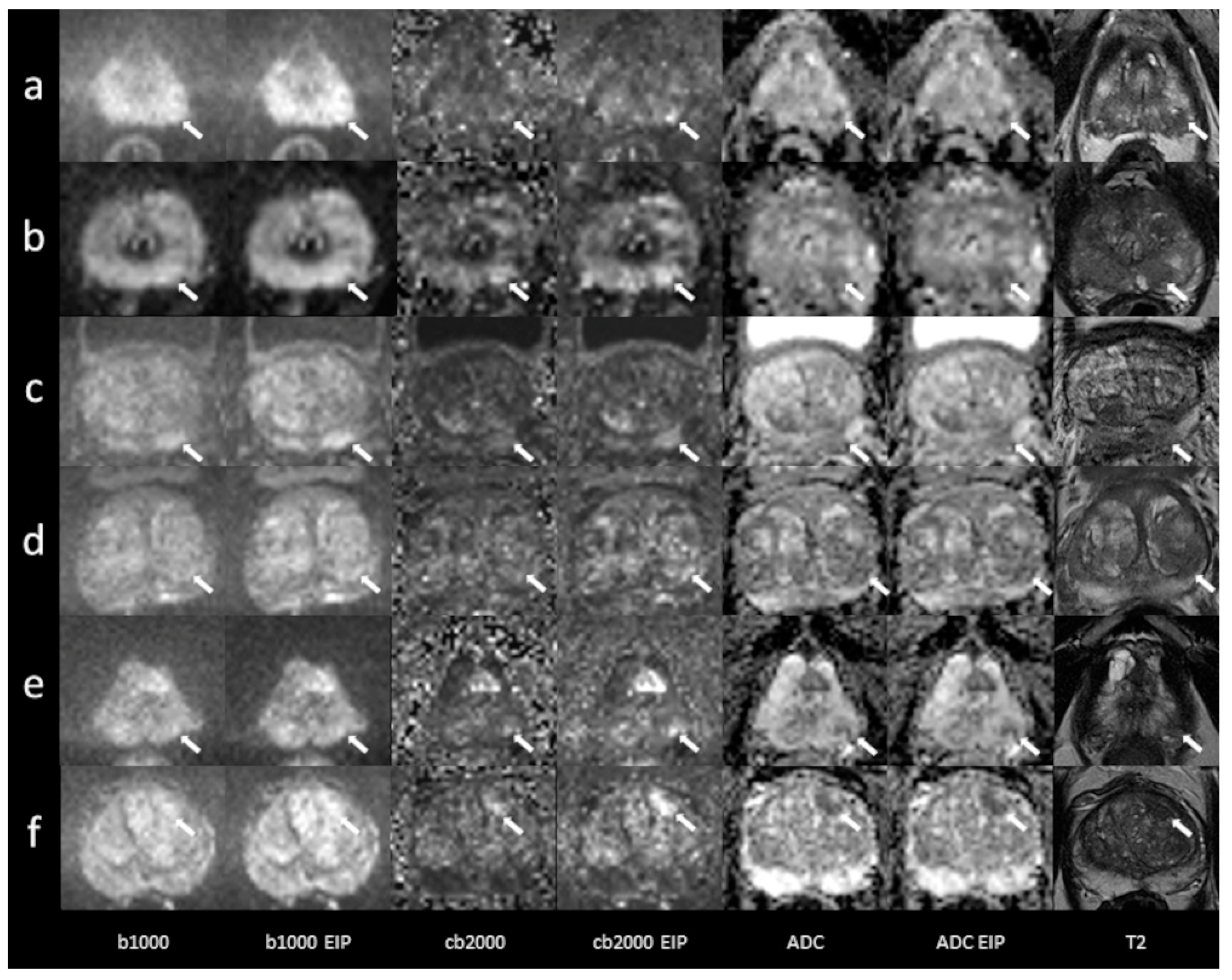 Diagnostics 13 02325 g006 Diagnostics 13 02325 g006