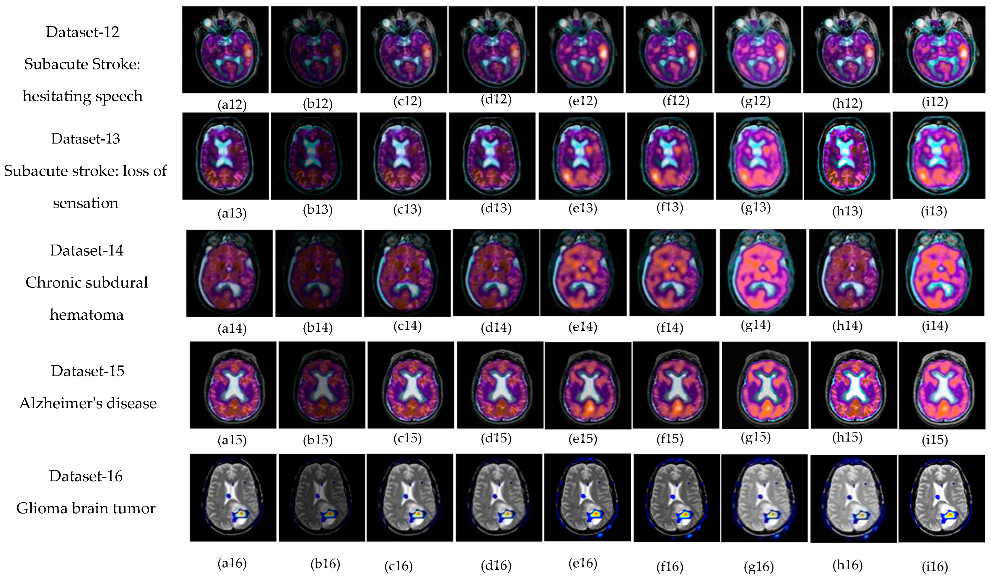 Diagnostics 13 02330 g004b