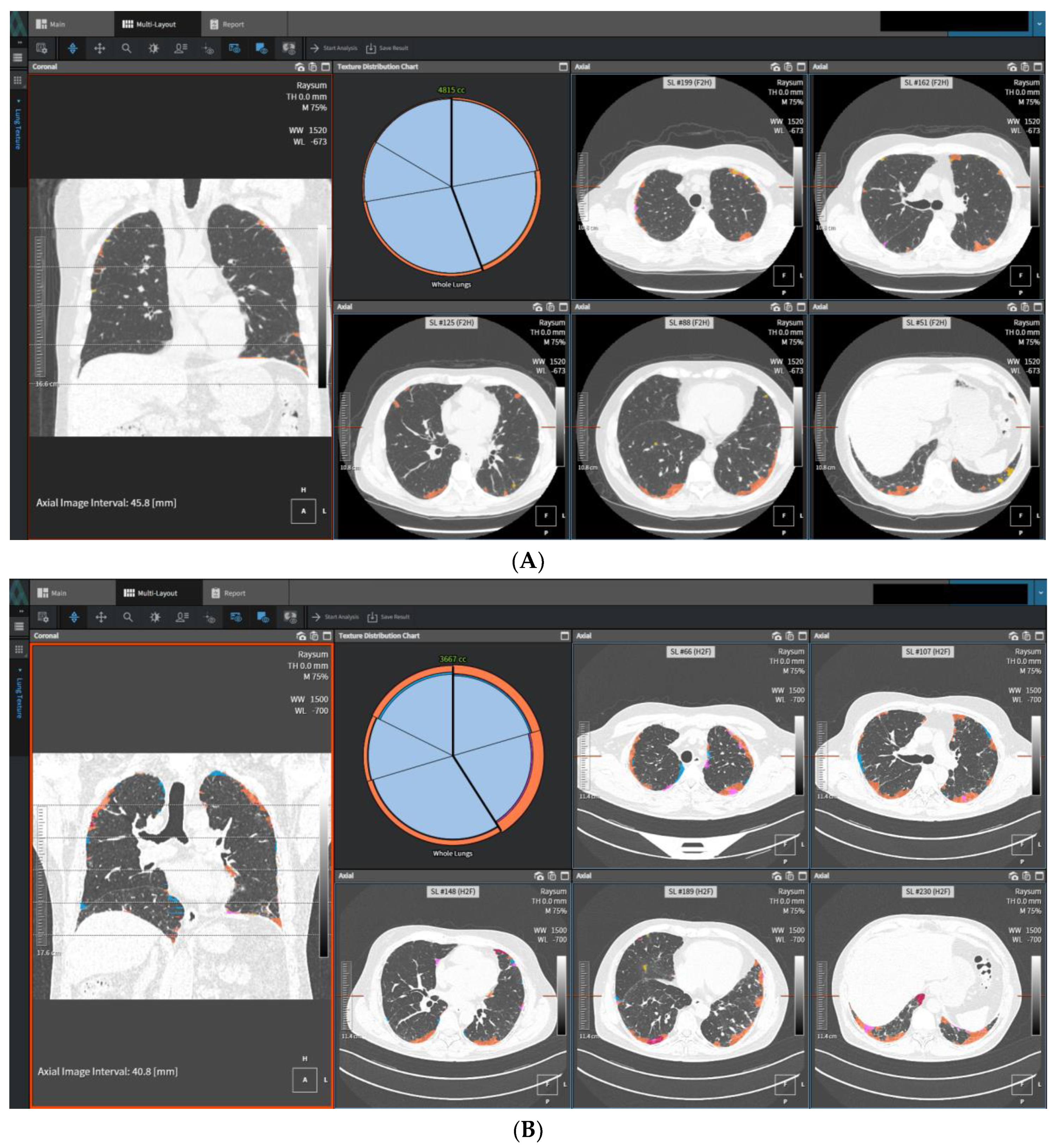 Diagnostics 13 02333 g003 Diagnostics 13 02333 g003