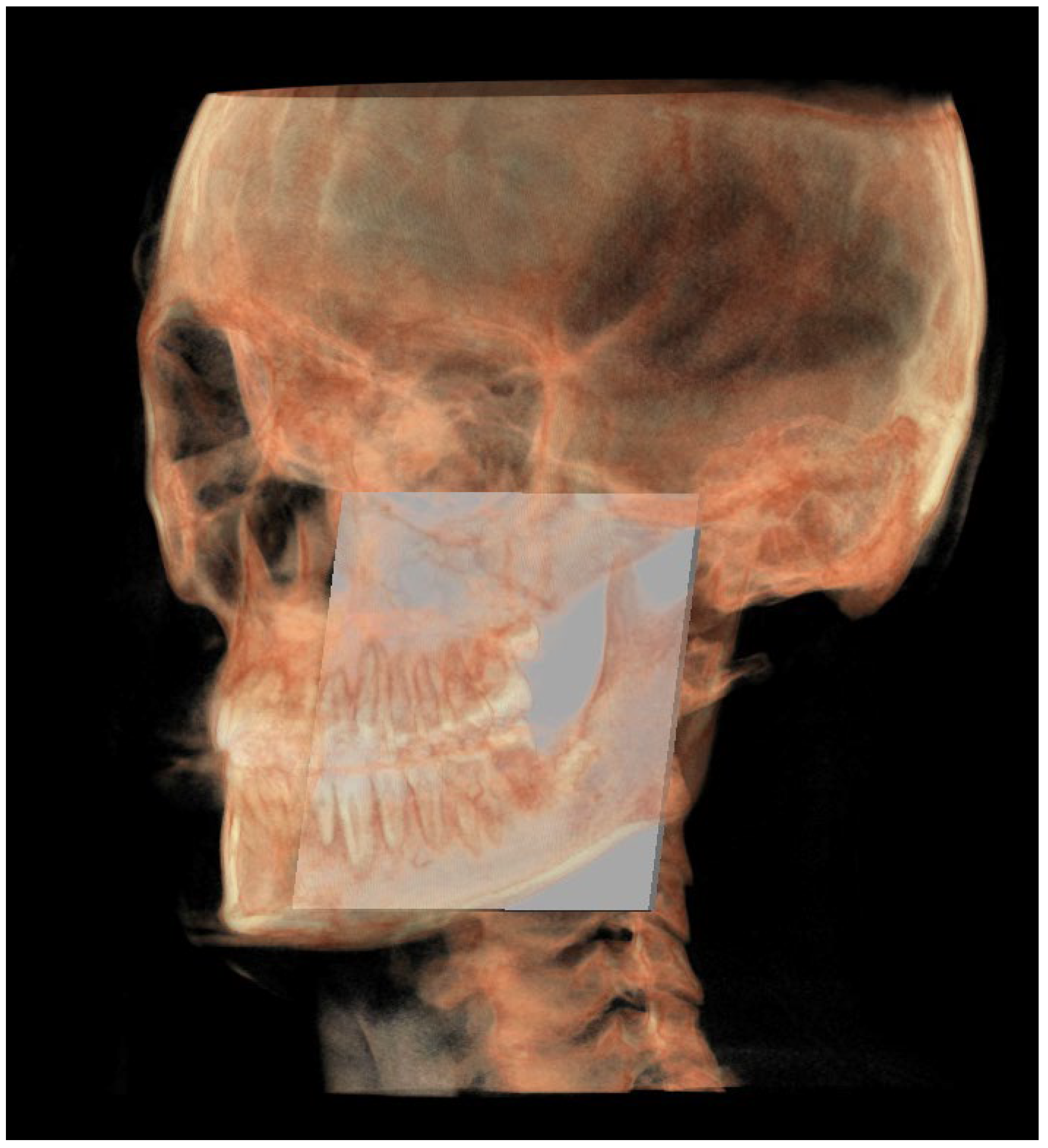 Diagnostics 13 02337 g005 Diagnostics 13 02337 g005