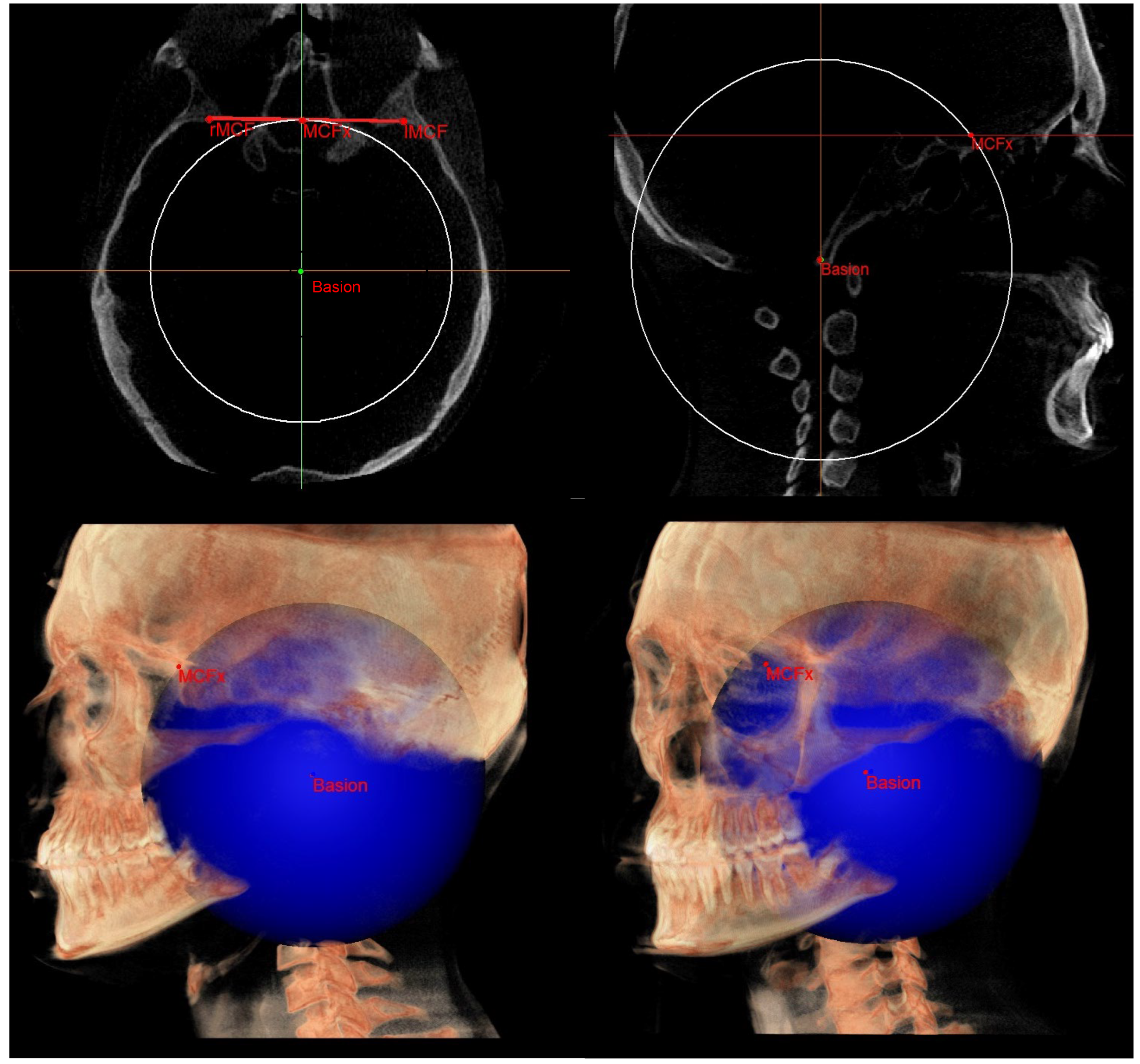 Diagnostics 13 02337 g008 Diagnostics 13 02337 g008