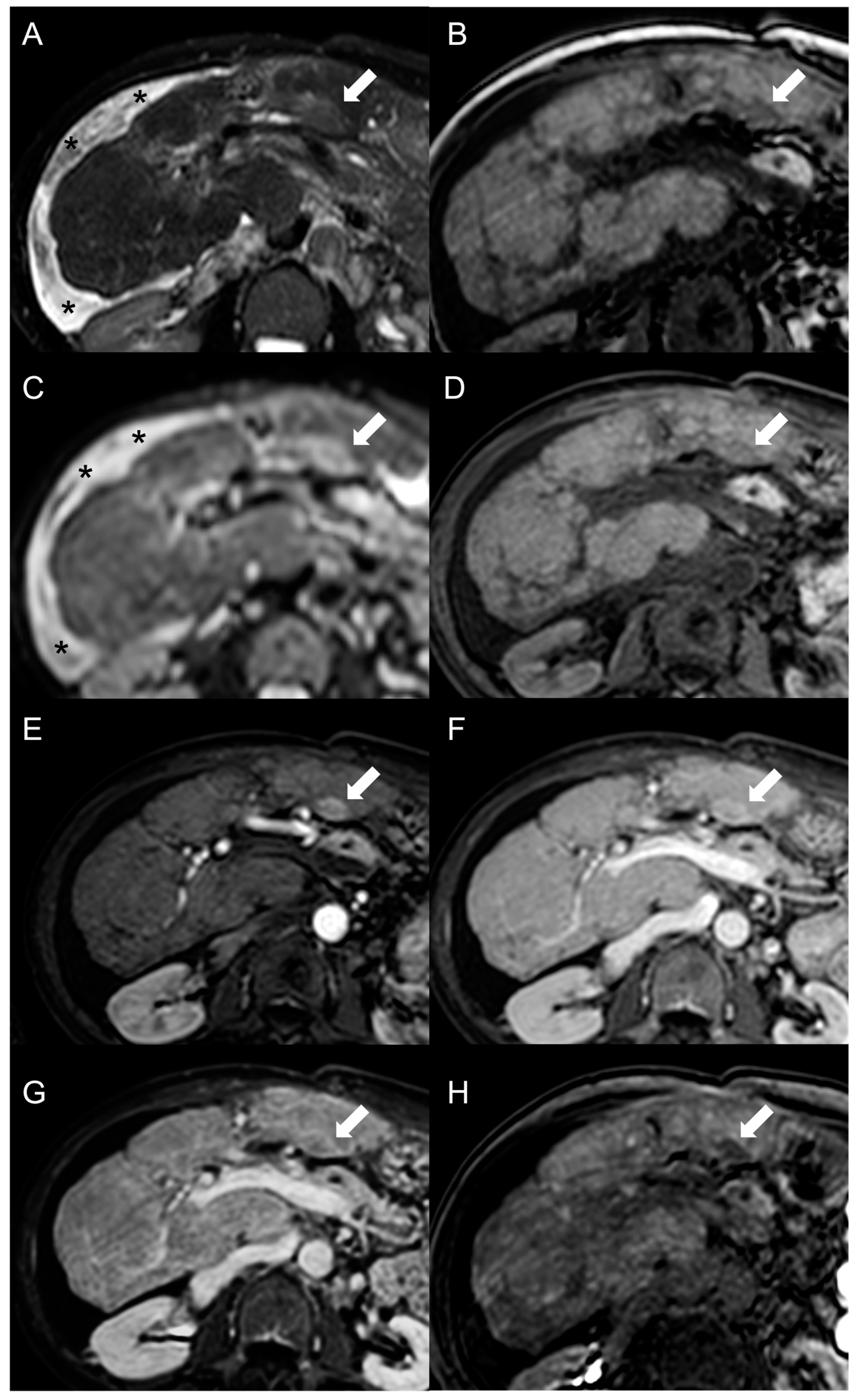 Diagnostics 13 02346 g006 Diagnostics 13 02346 g006