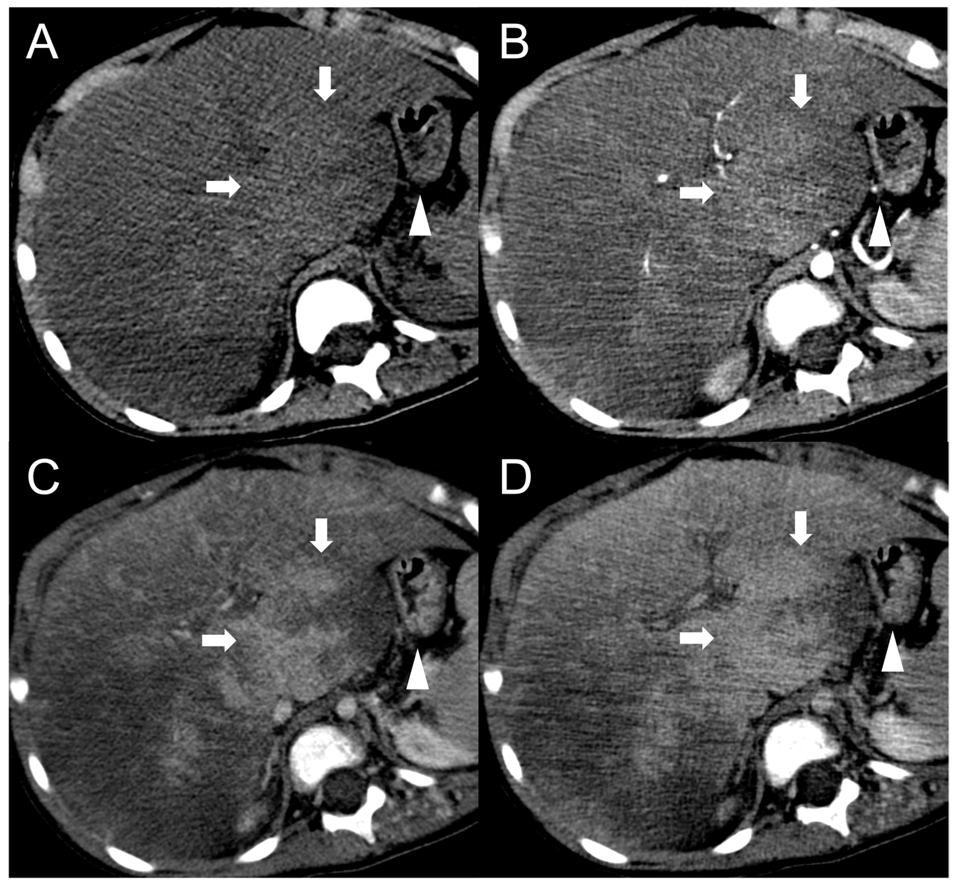 Diagnostics 13 02346 g008 Diagnostics 13 02346 g008