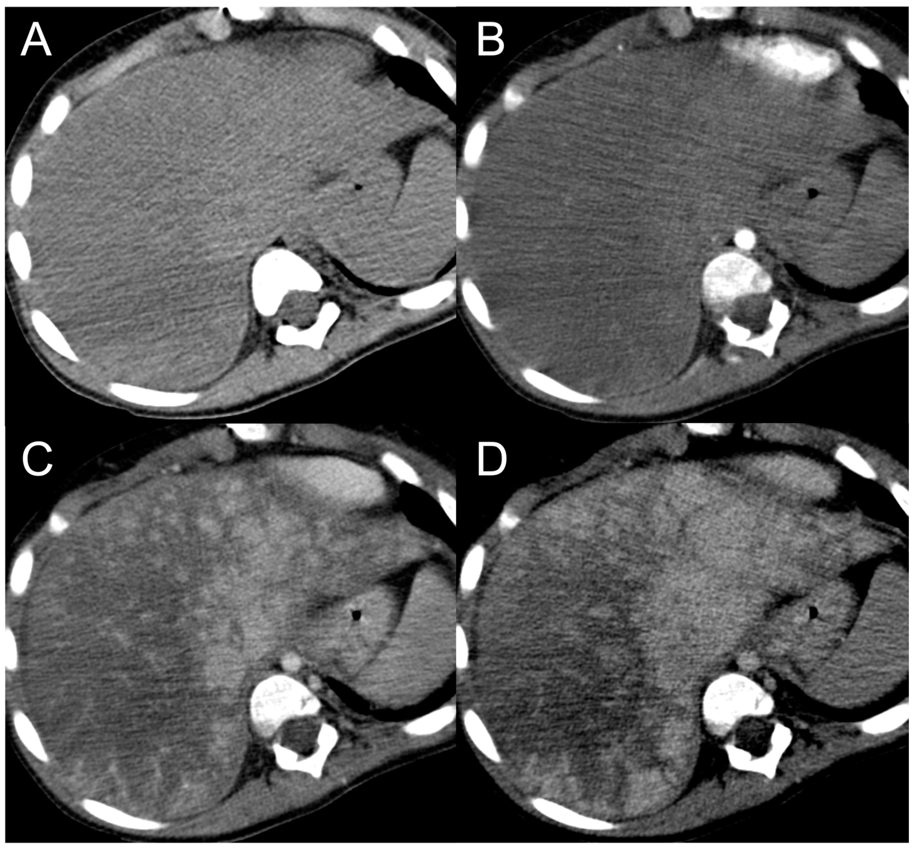Diagnostics 13 02346 g009 Diagnostics 13 02346 g009