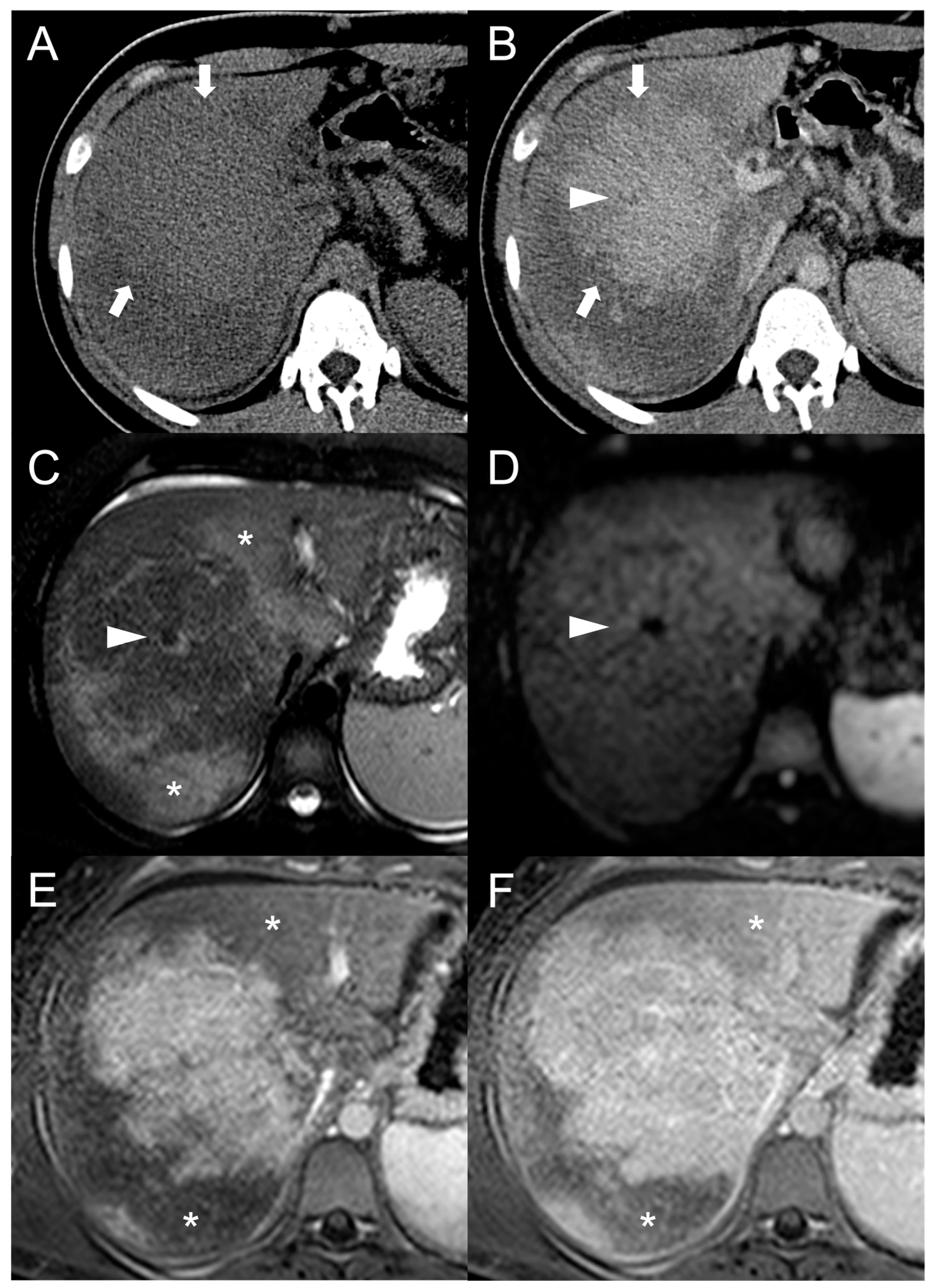 Diagnostics 13 02346 g010 Diagnostics 13 02346 g010