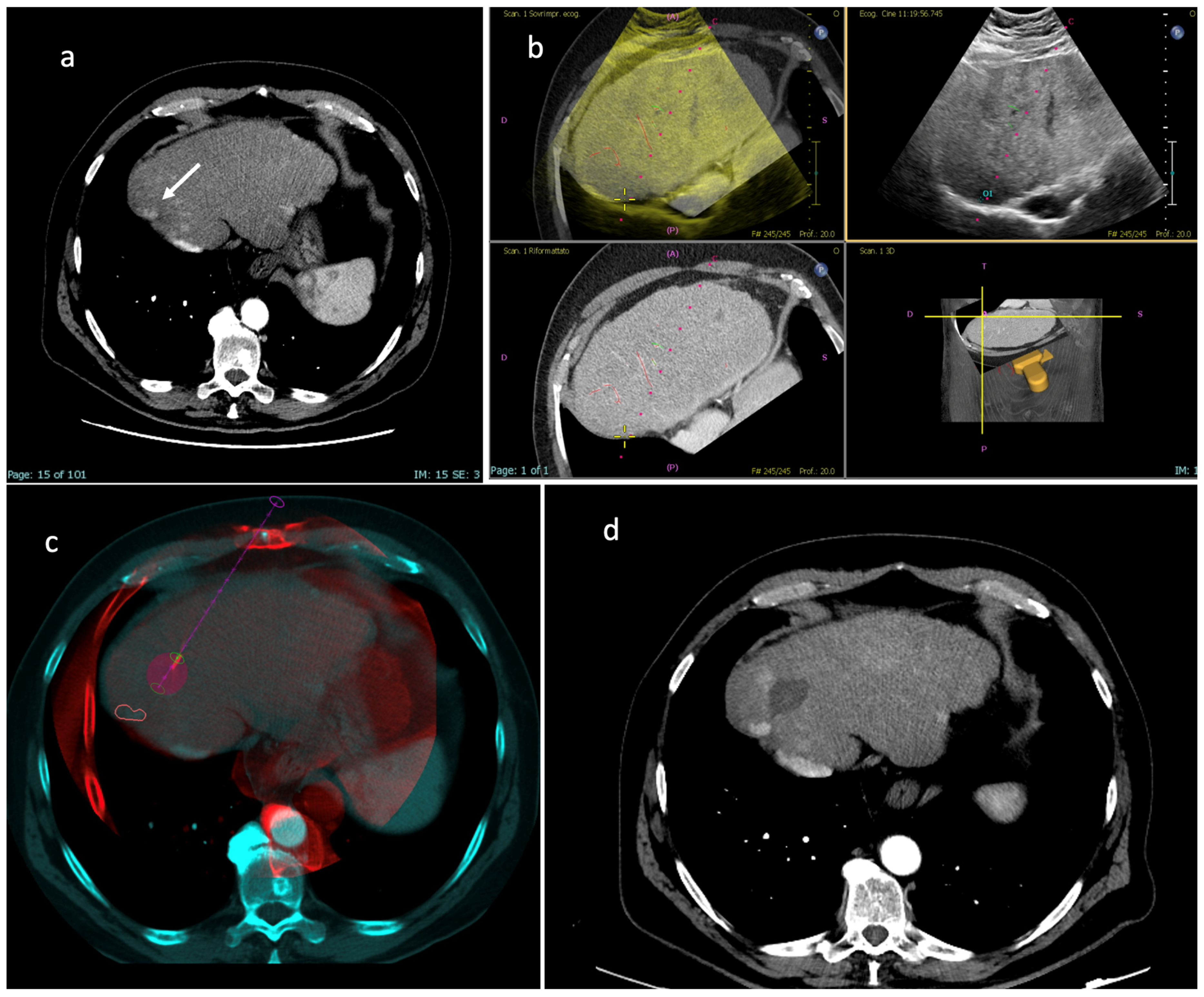 Diagnostics 13 02349 g005