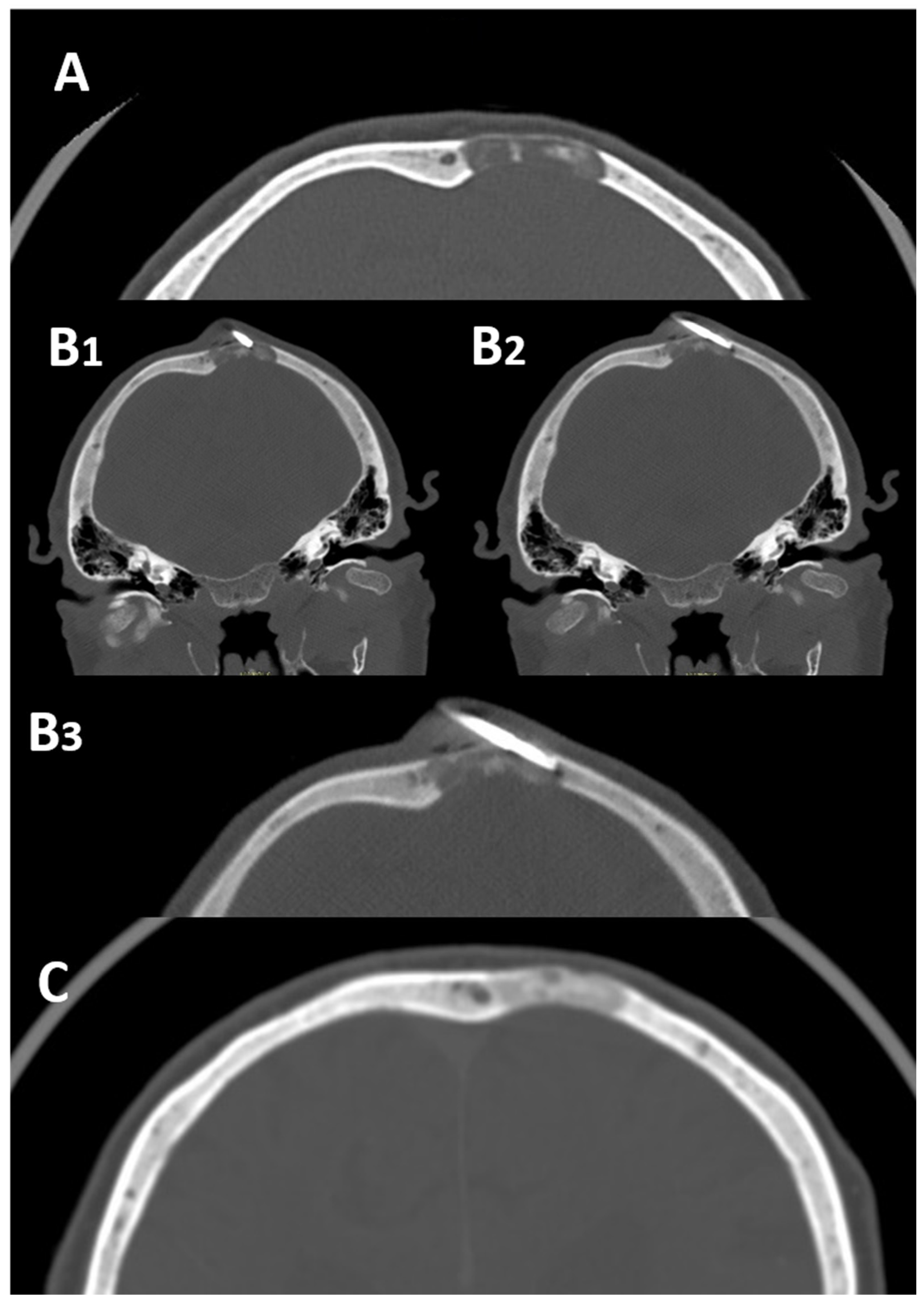 Diagnostics 13 02350 g003