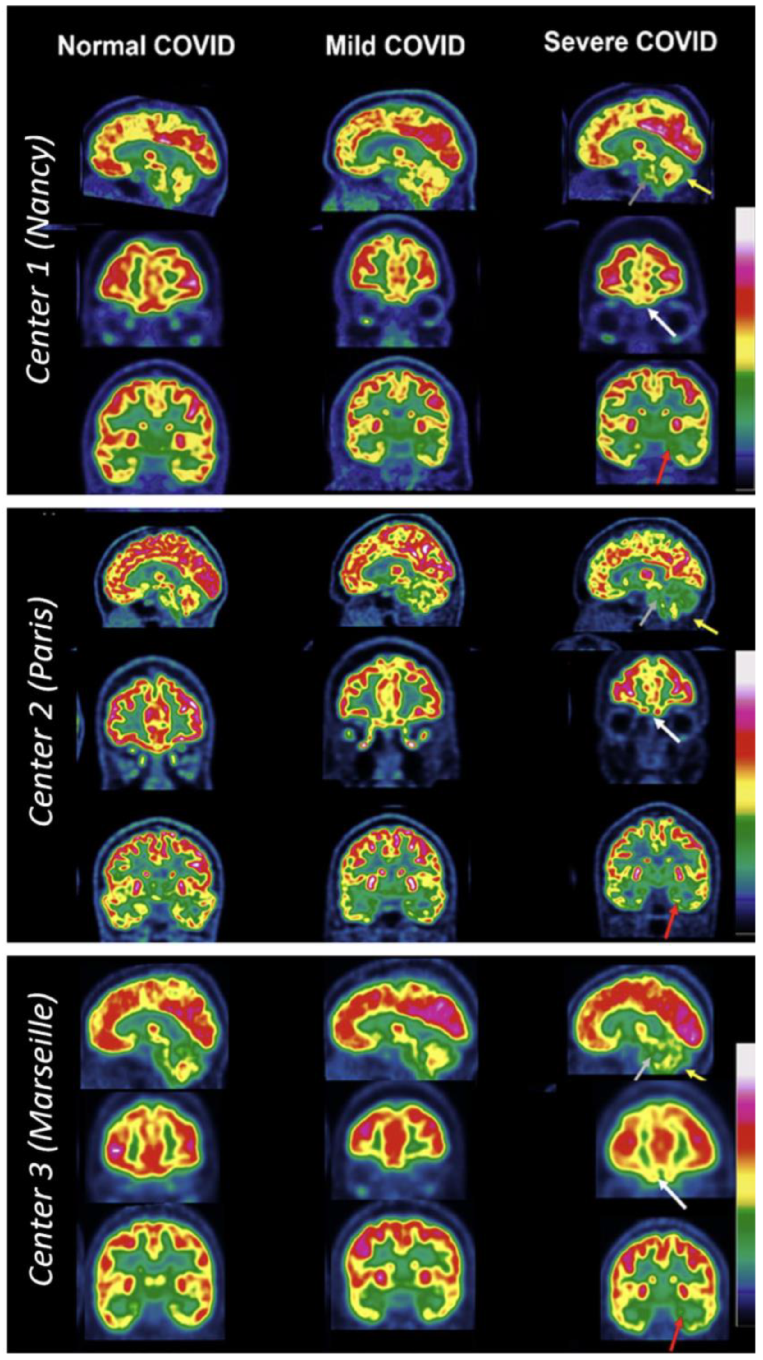 Diagnostics 13 02353 g001 Diagnostics 13 02353 g001