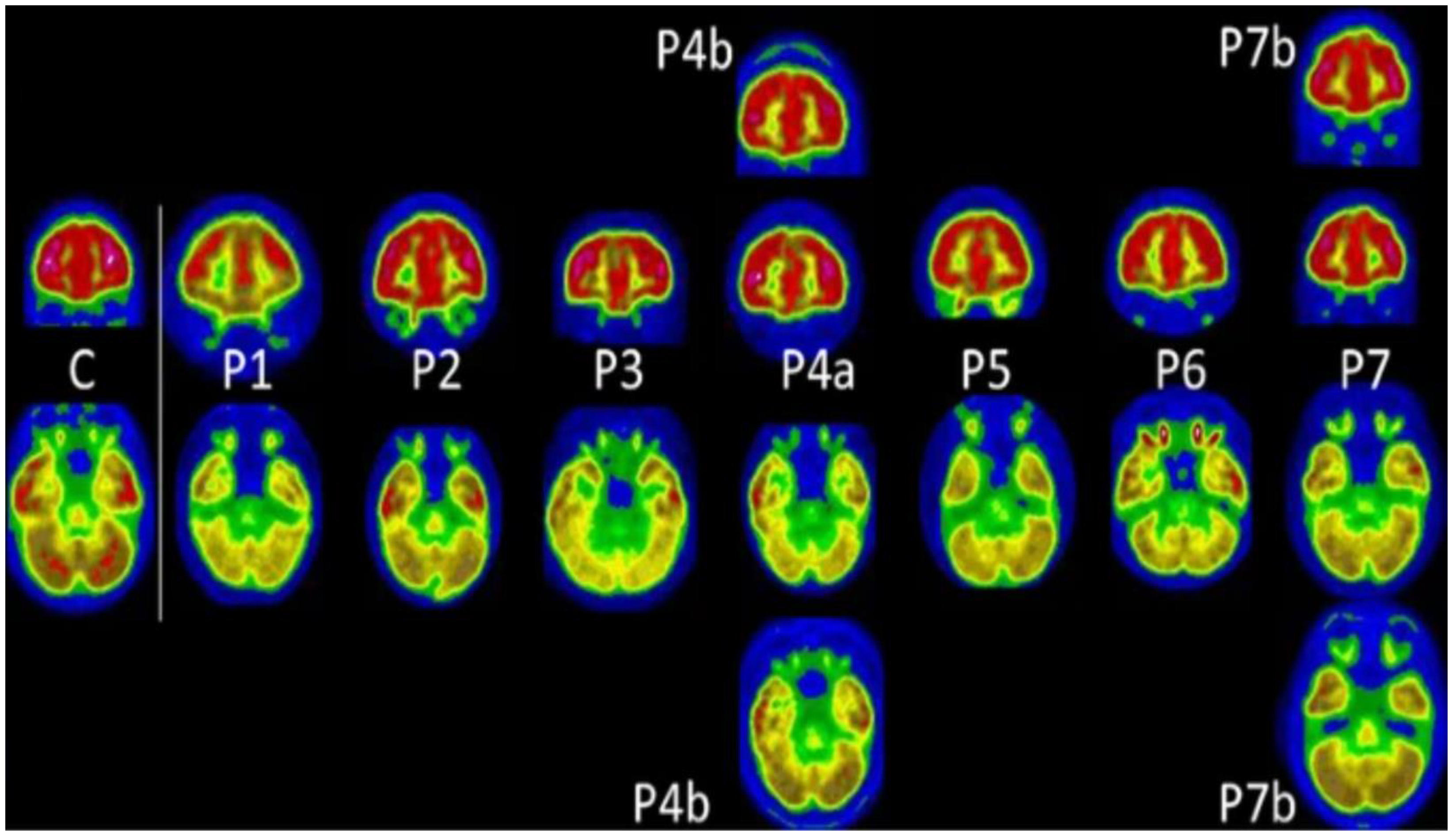 Diagnostics 13 02353 g005 Diagnostics 13 02353 g005