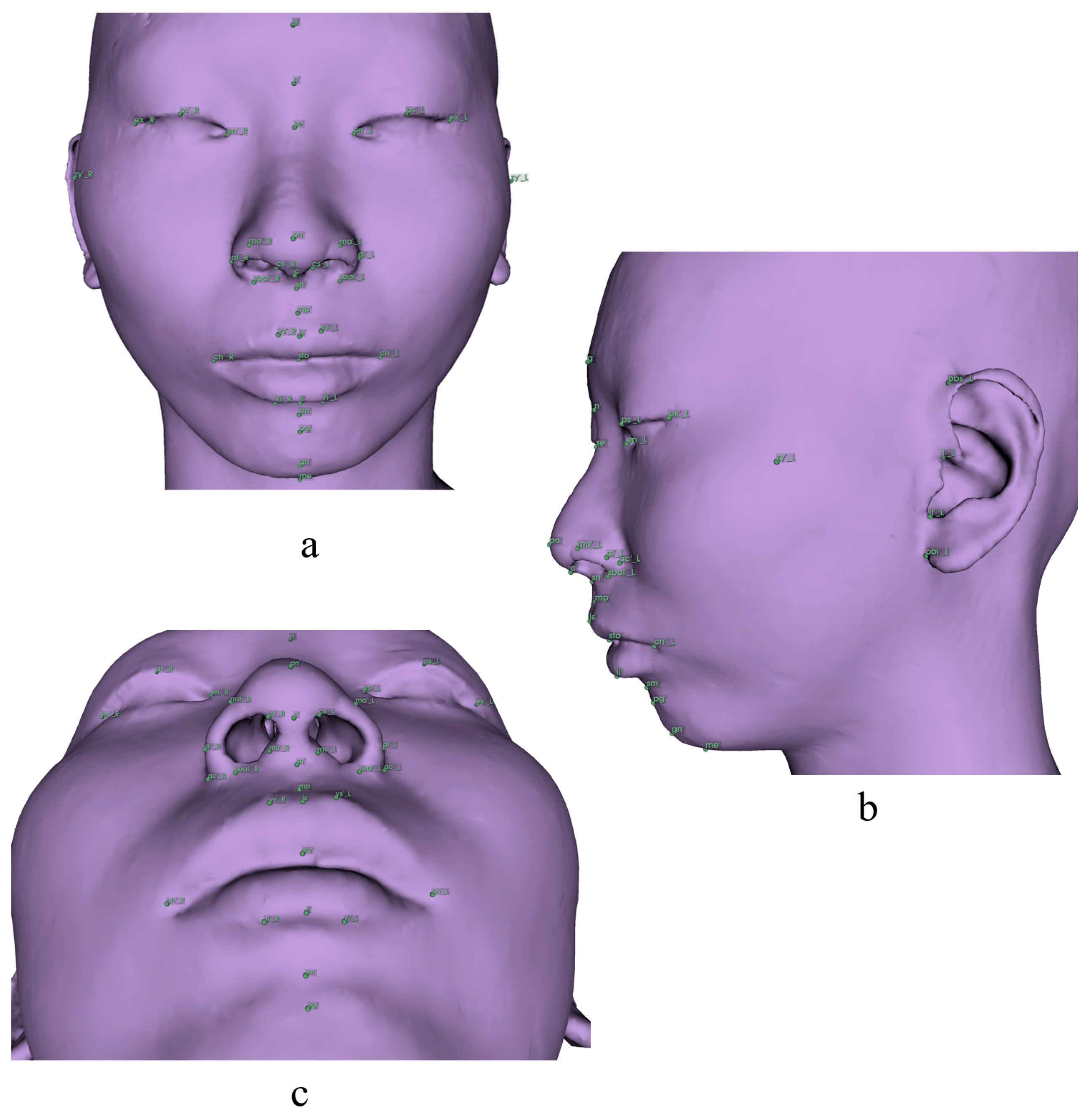 Diagnostics 13 02360 g004