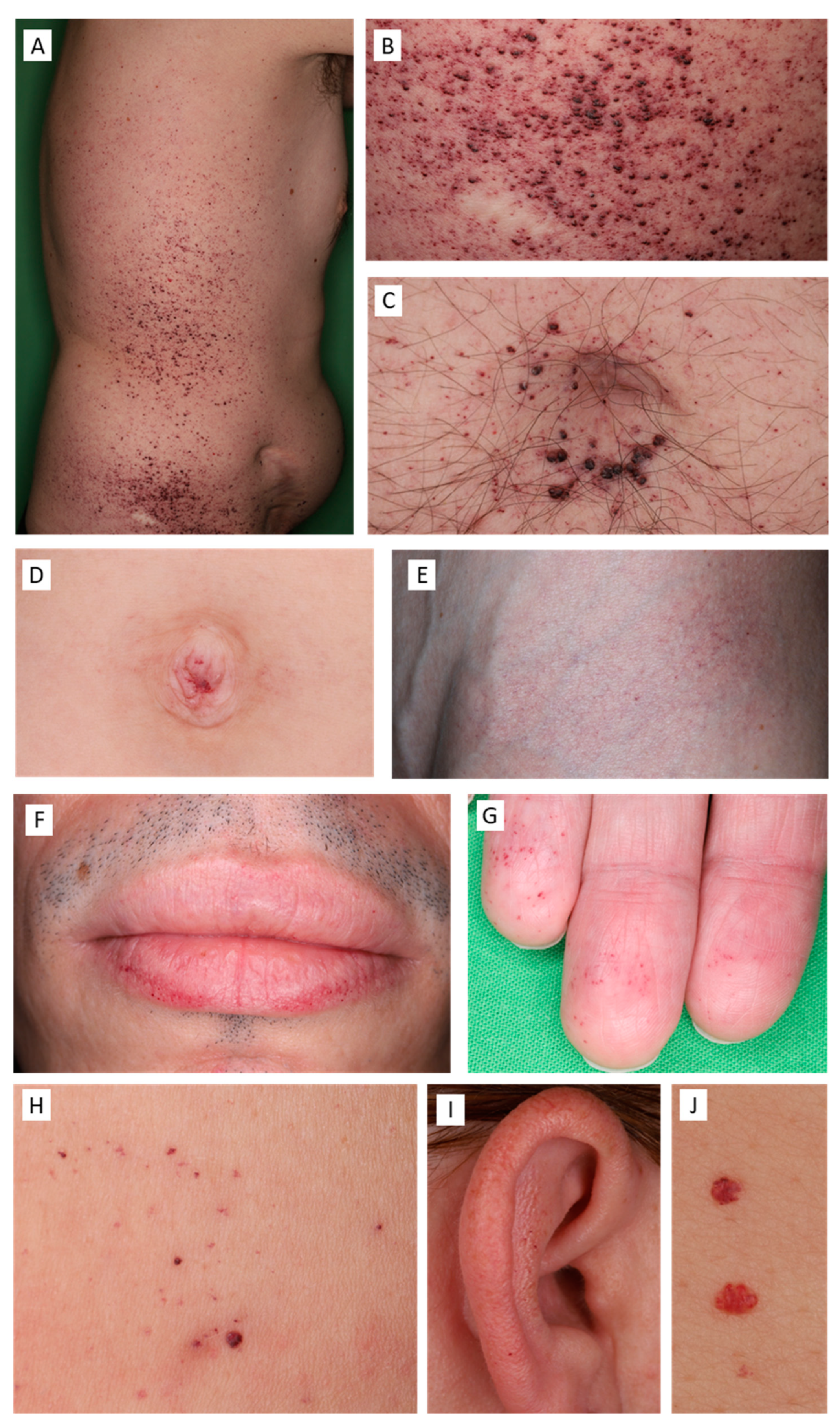 Diagnostics 13 02368 g002 Diagnostics 13 02368 g002