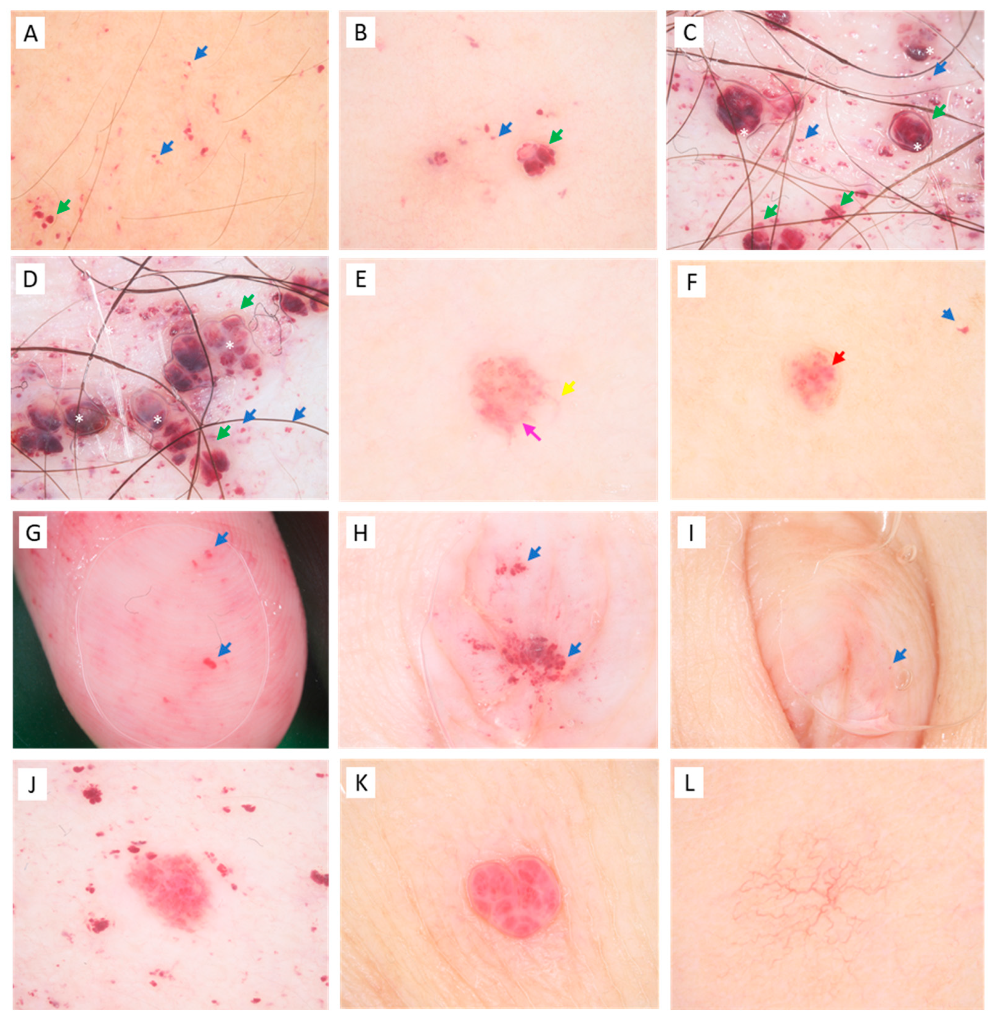 Diagnostics 13 02368 g005 Diagnostics 13 02368 g005