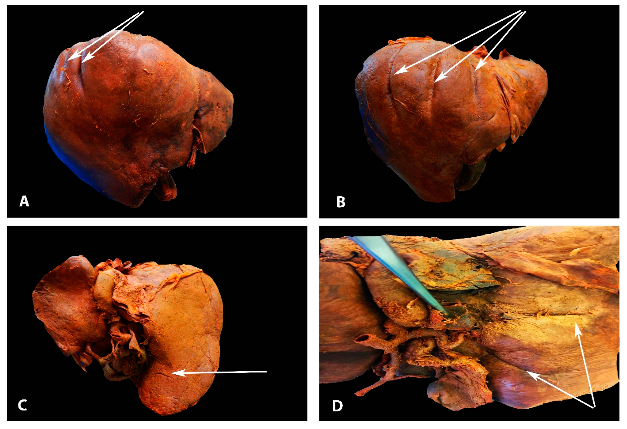 Diagnostics 13 02371 g003 Diagnostics 13 02371 g003