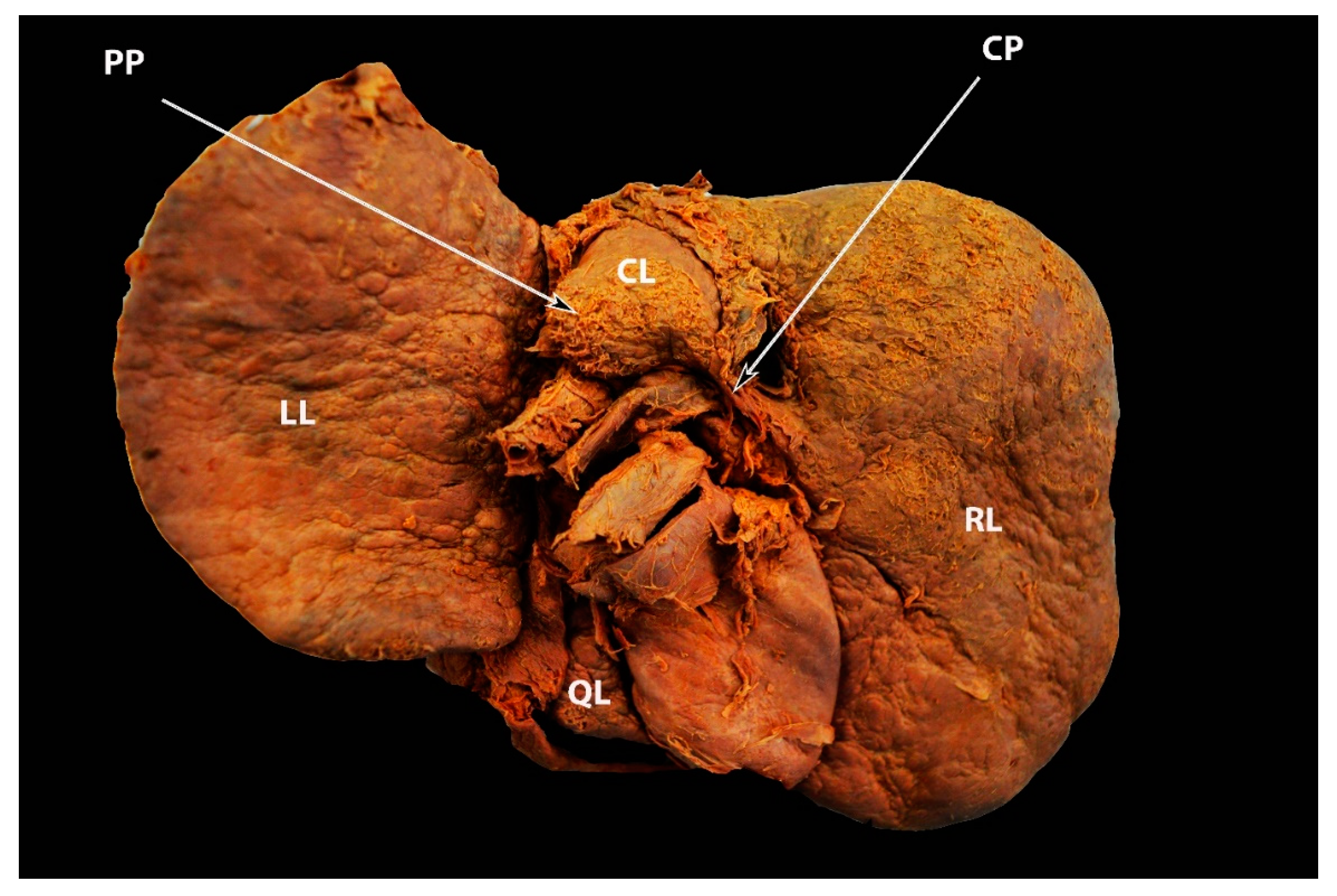 Diagnostics 13 02371 g006 Diagnostics 13 02371 g006