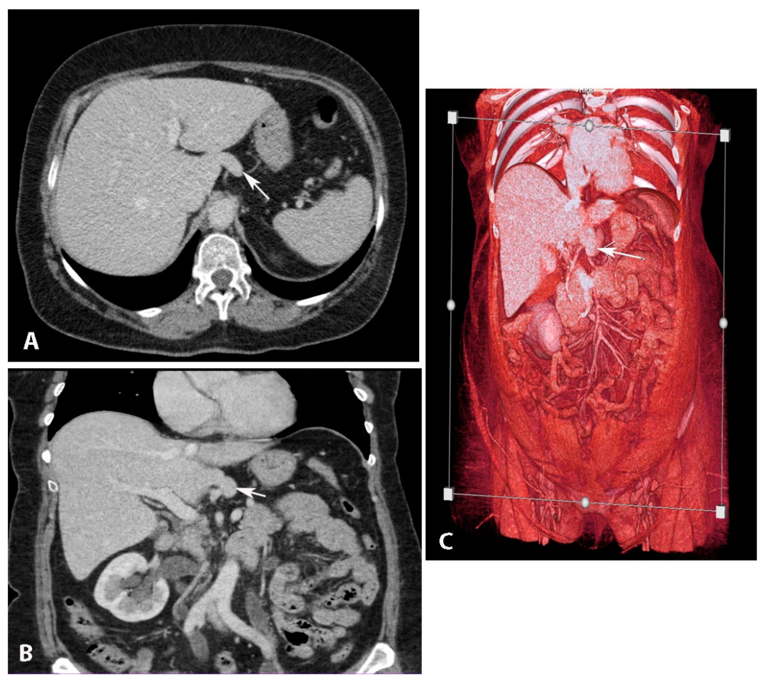 Diagnostics 13 02371 g008 Diagnostics 13 02371 g008