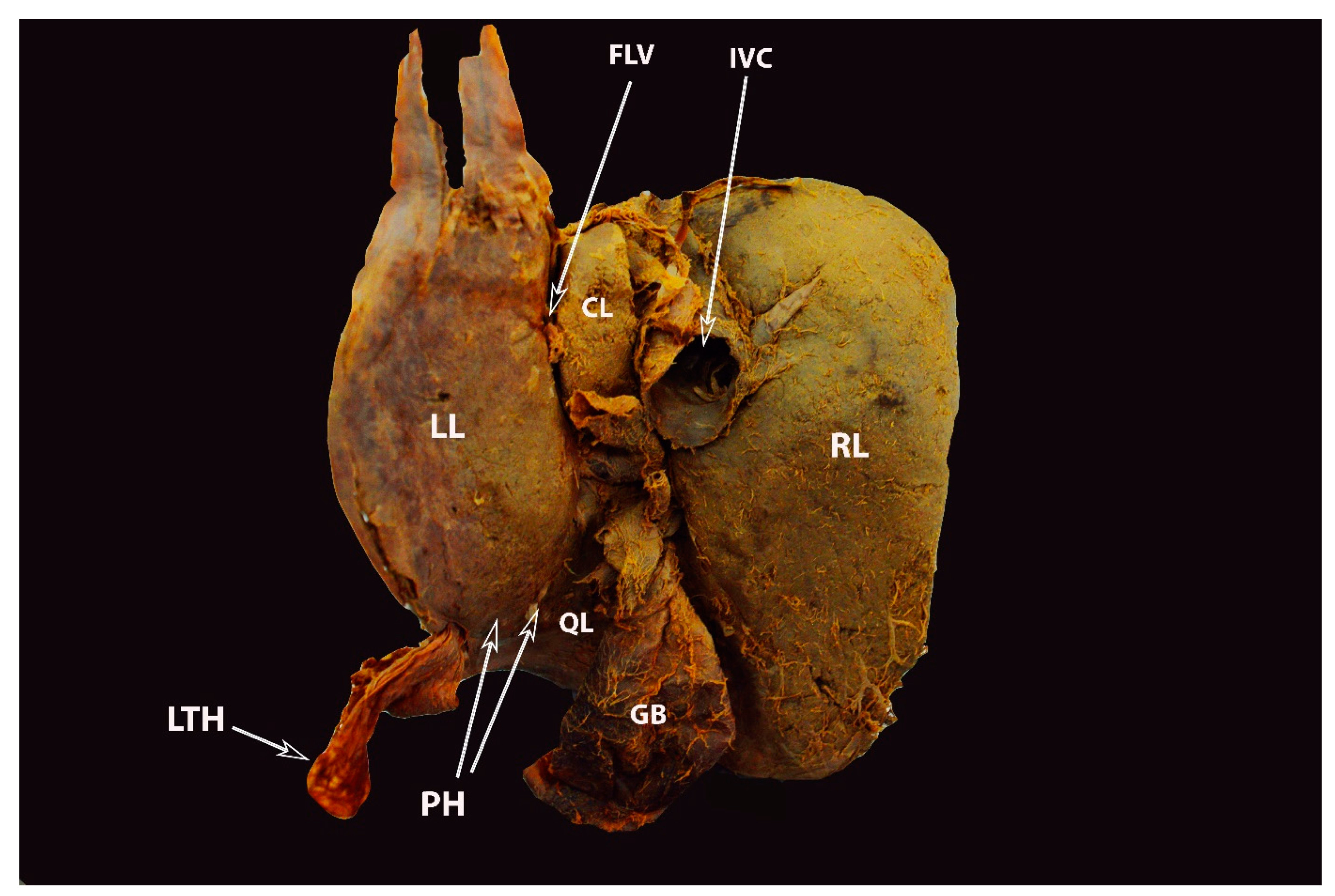Diagnostics 13 02371 g009 Diagnostics 13 02371 g009